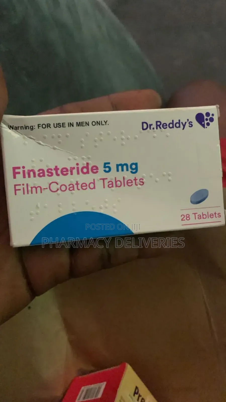 Baldness Hair Loss Treatment With Minioxidil Finisteride
