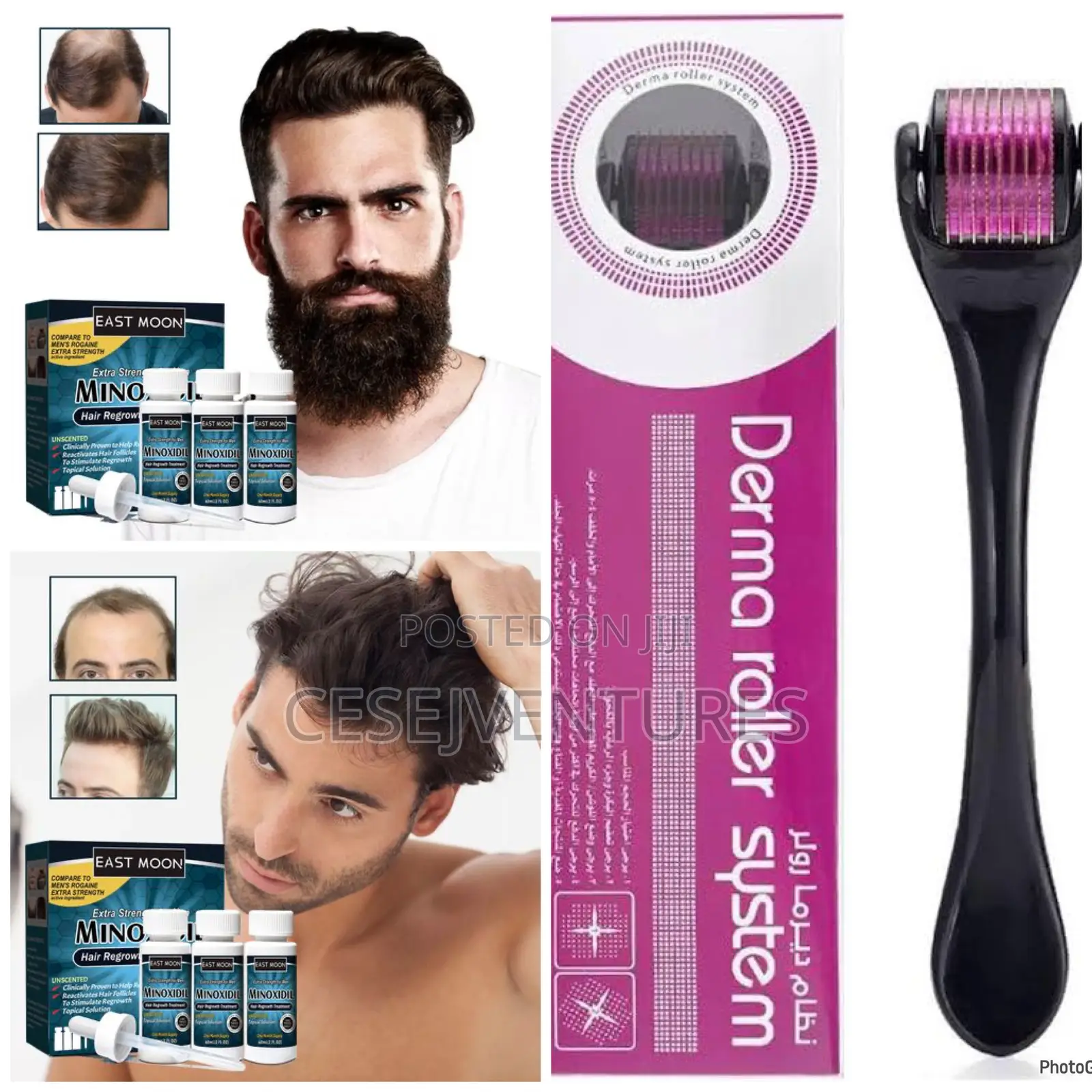 East Moon Minoxidil Beard Growth Treatment for Men