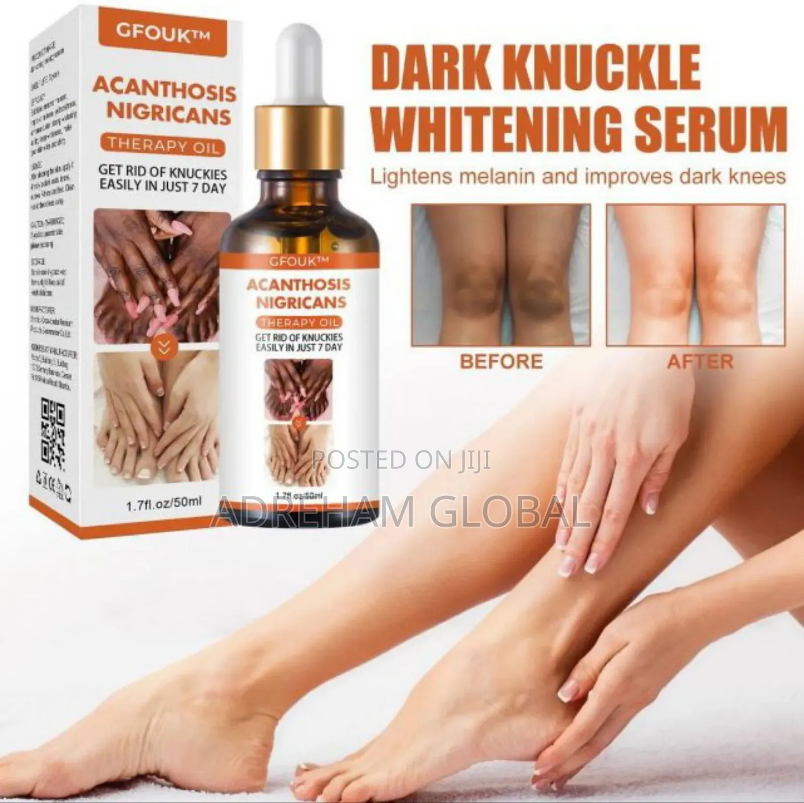 Dark Knuckle Whitening Serum–Superb Restoration Therapy Oil
