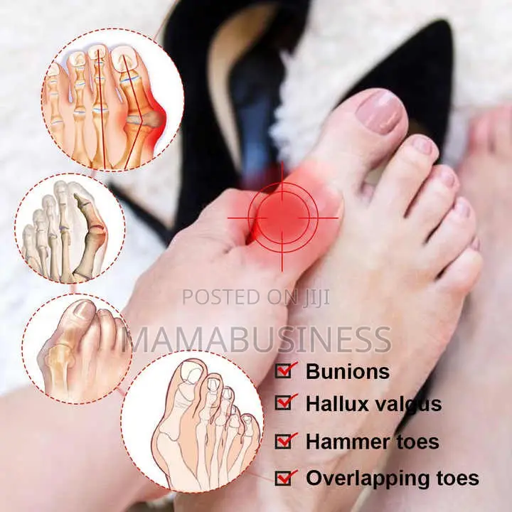 Sumifun Bunion Pain Relief Spray - 20g