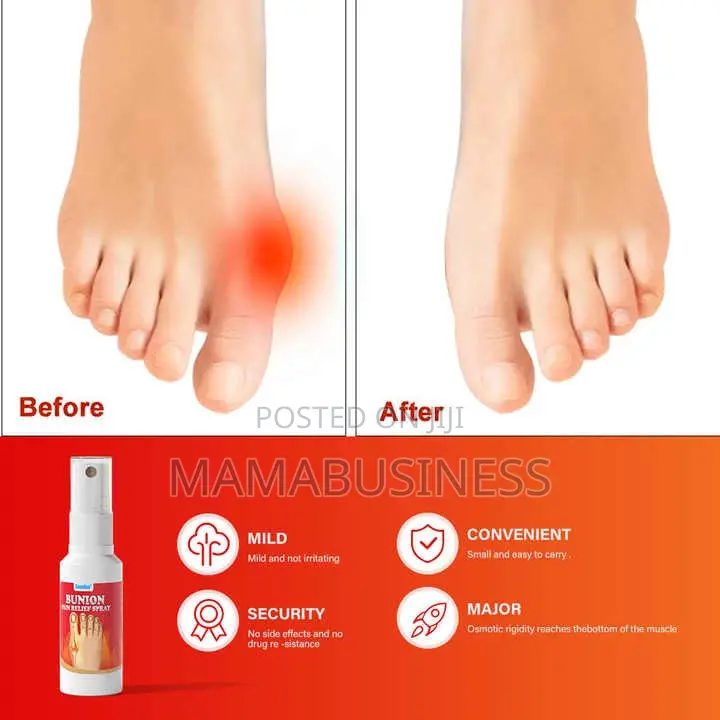 Sumifun Bunion Pain Relief Spray - 20g