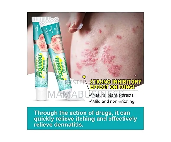 Kanye HB Psoriasis Cream Bacteriostasis - 20g