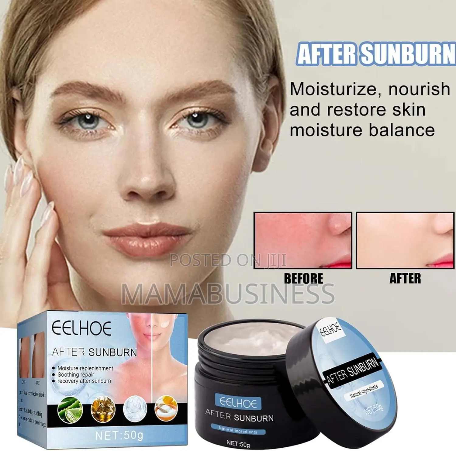 Eelhoe After Sunburn Cream - 50g