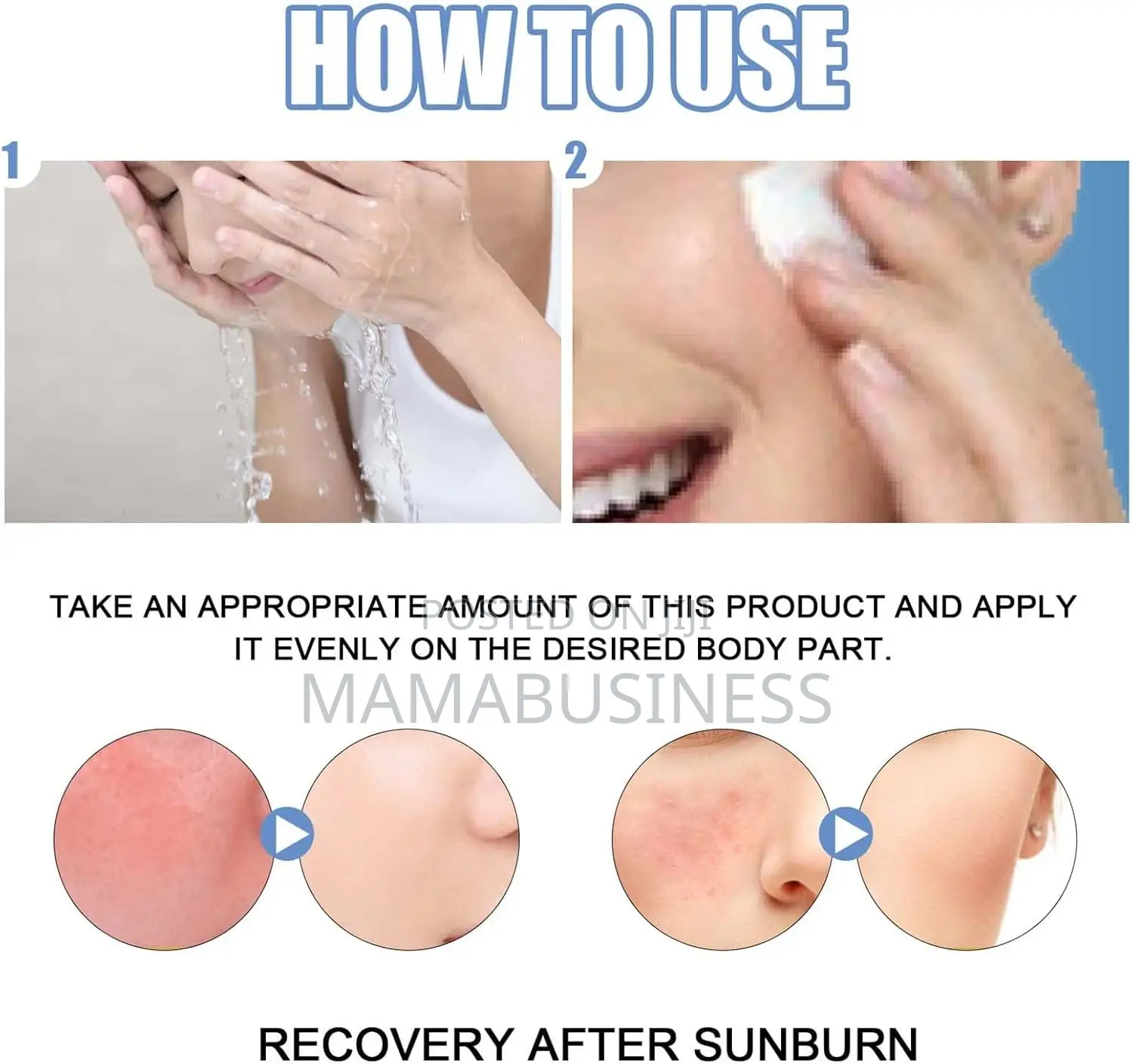 Eelhoe After Sunburn Cream - 50g