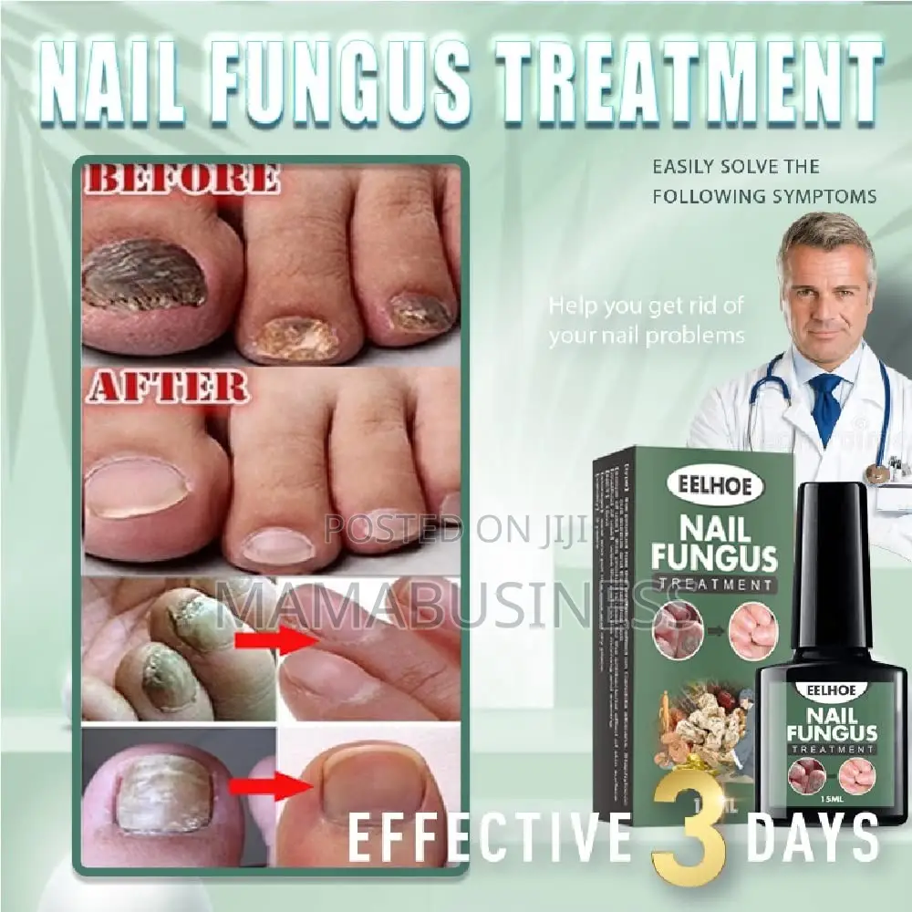 Eelhoe Nail Fungus Treatment - 15ml