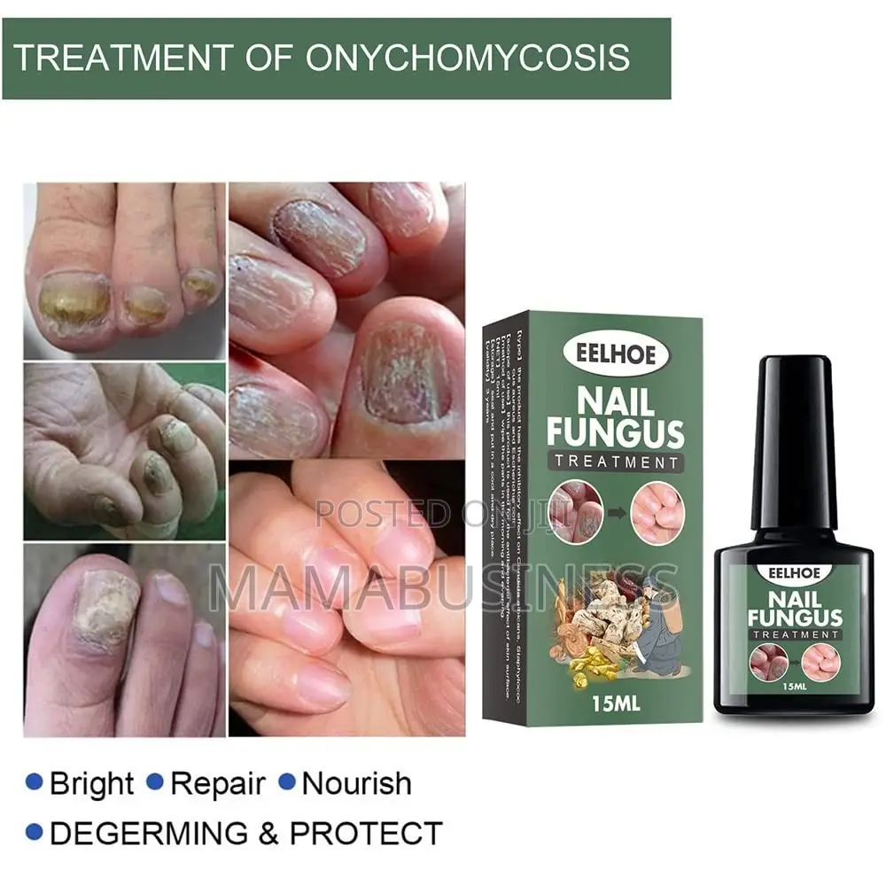 Eelhoe Nail Fungus Treatment - 15ml