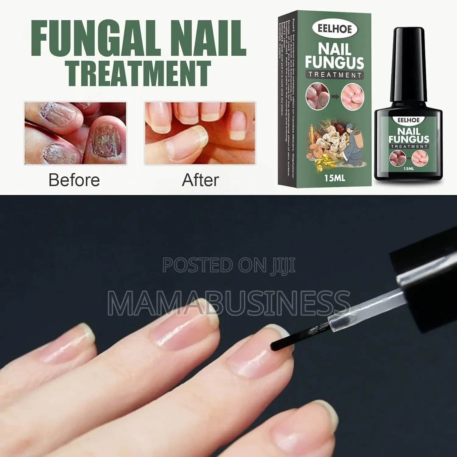 Eelhoe Nail Fungus Treatment - 15ml
