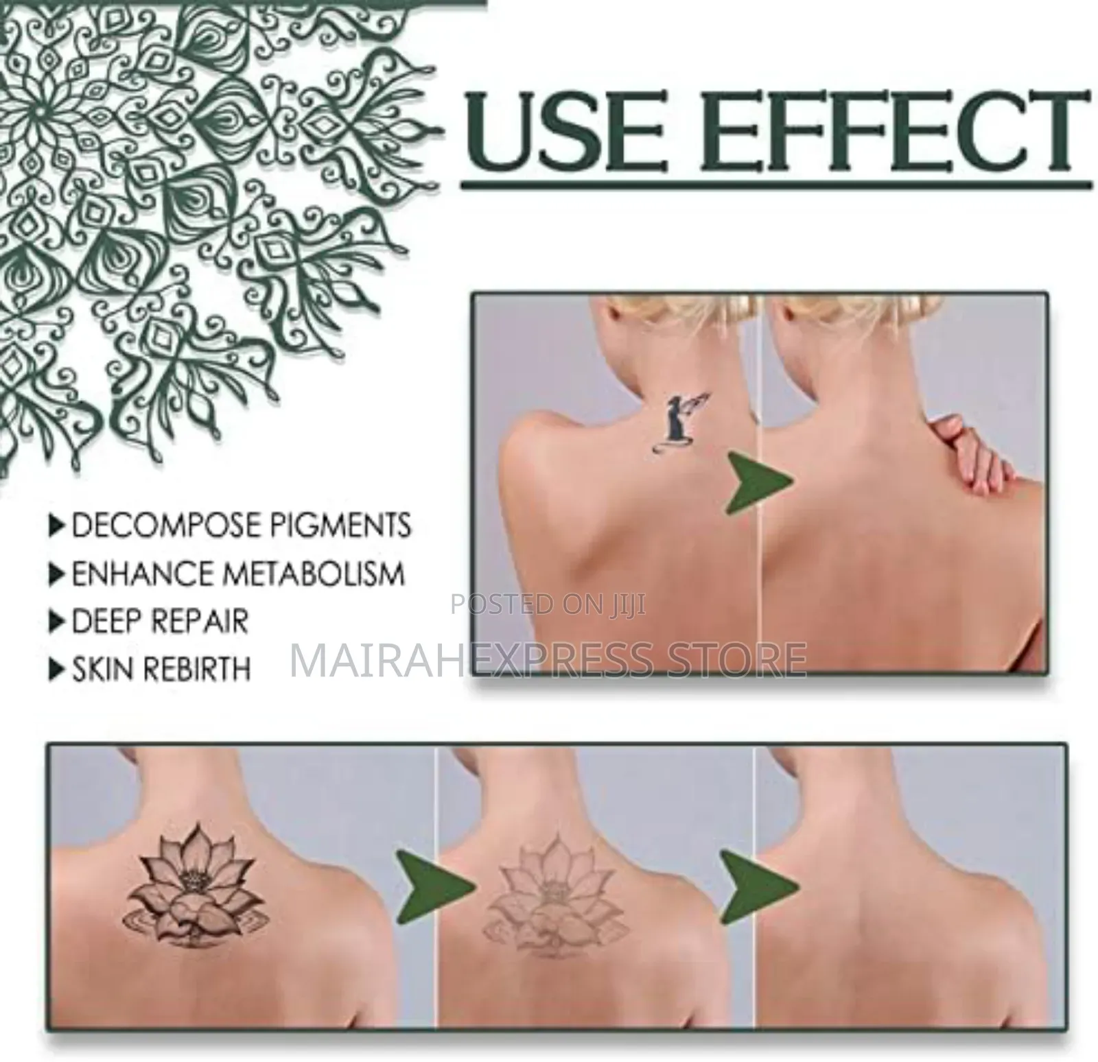 Tattoo Removal Spray (Hmk)