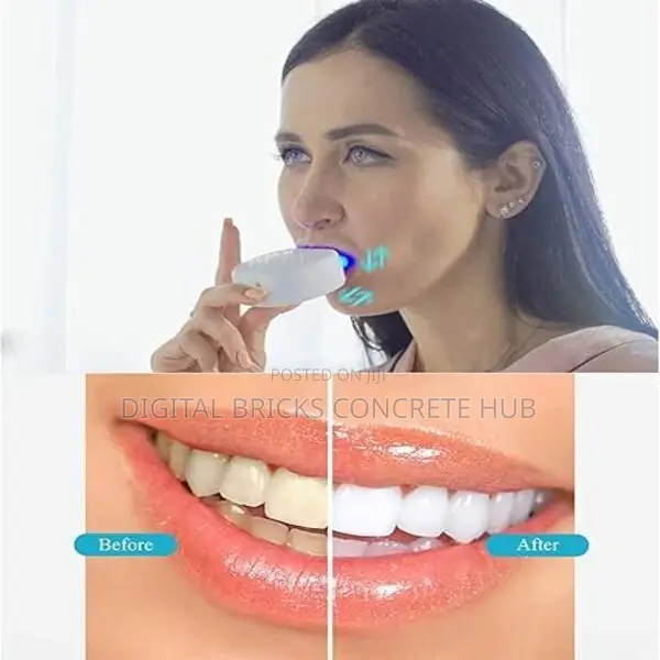 1minute Smart Toothbrush ,Rechargeable ,Whitening