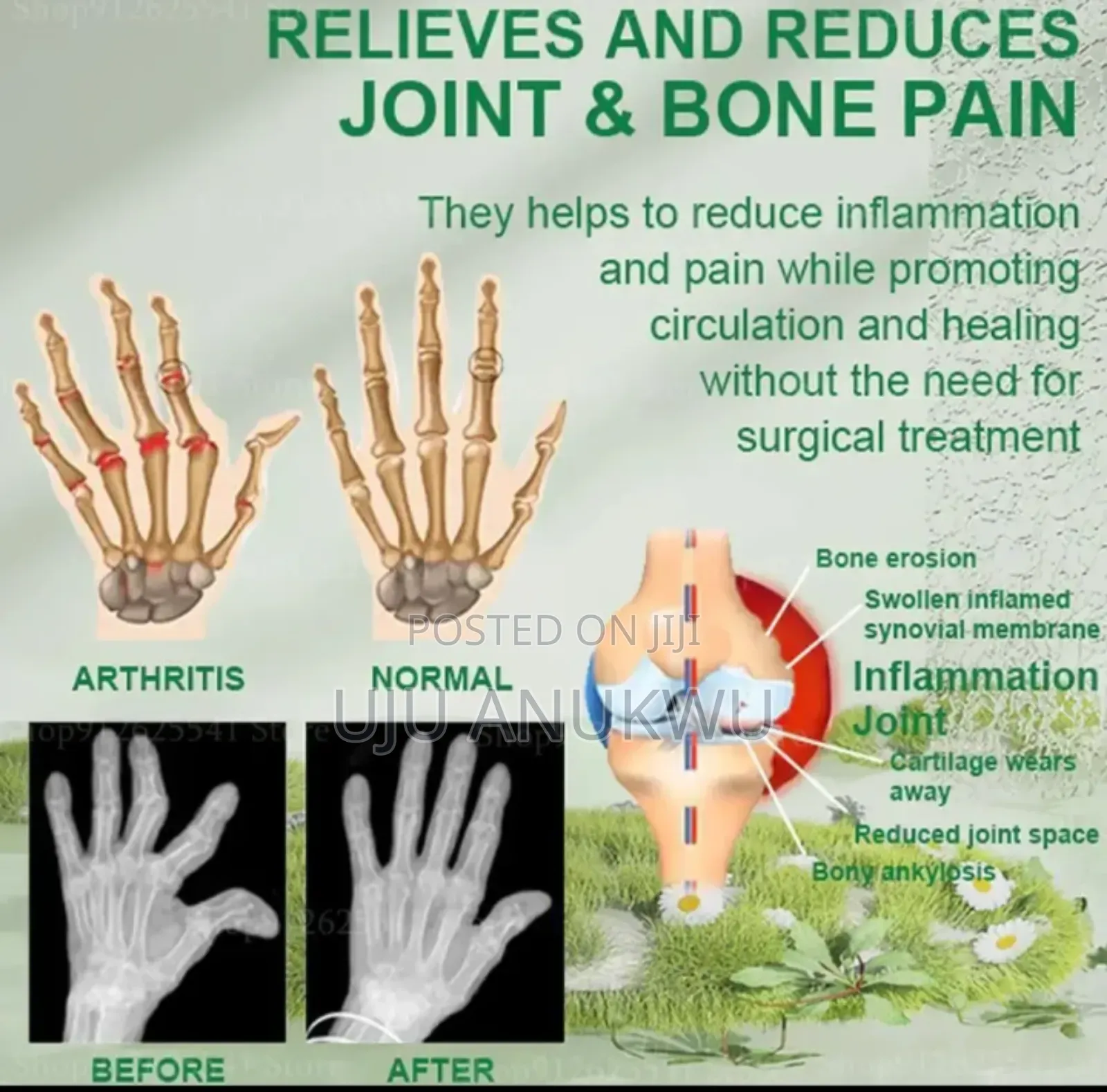 Beevana Bee Venom Joint Bone, Arthritis Cream