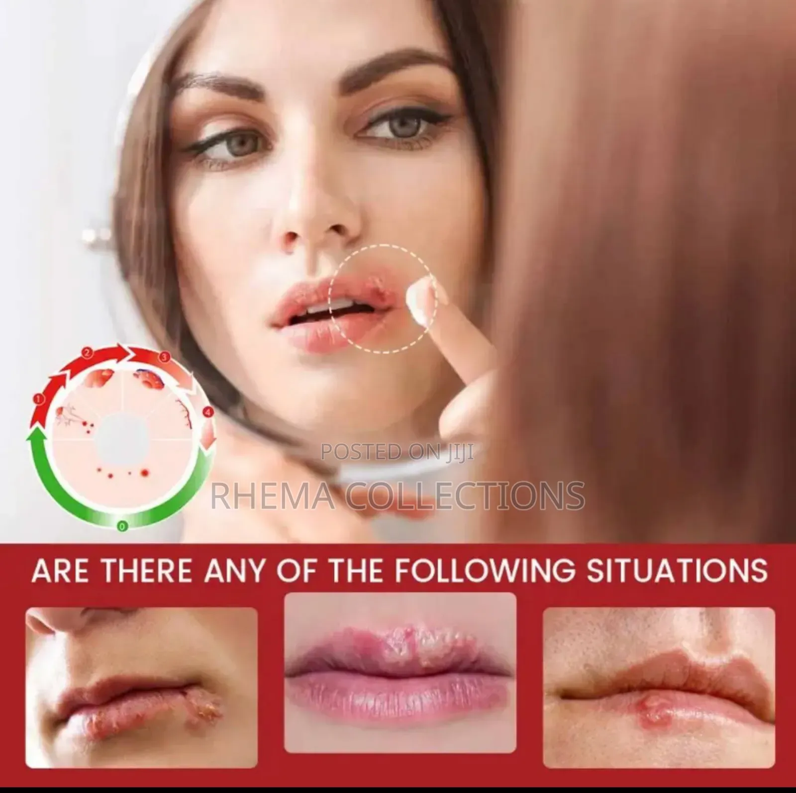 Sumifun Cold Sore Relief Cream (20g)