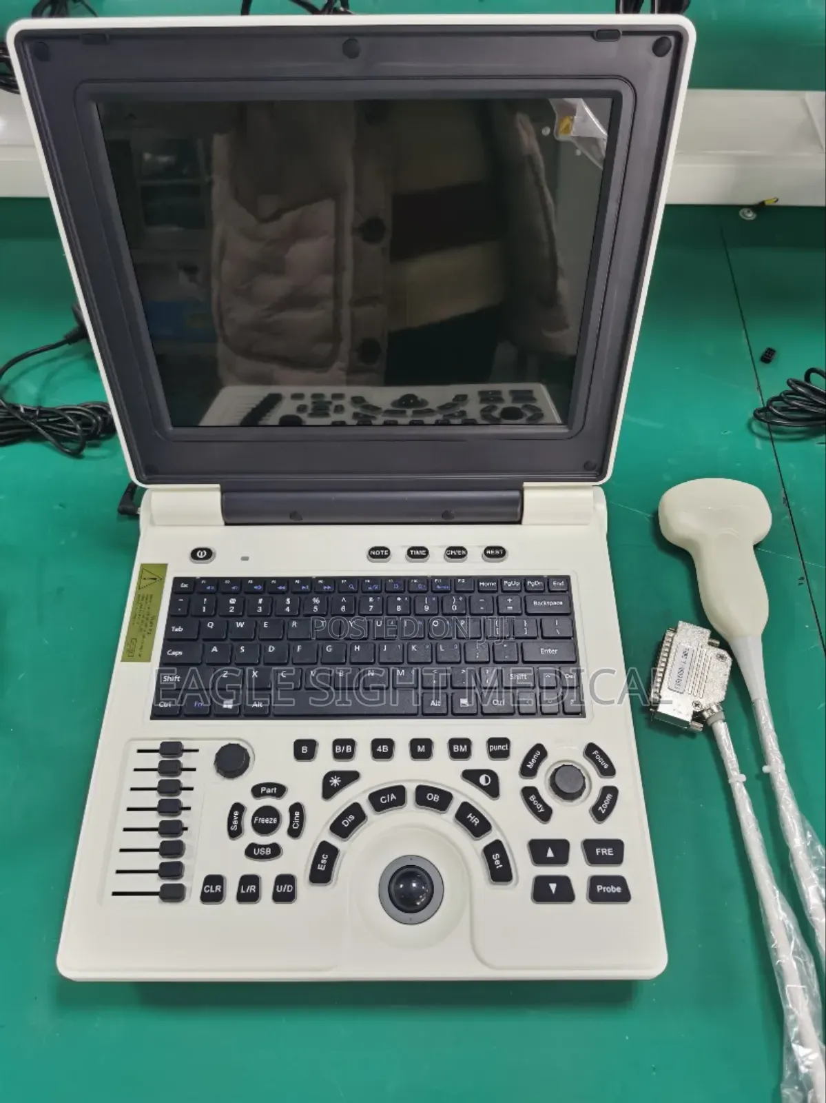Ultrasound Machine Laptop Type