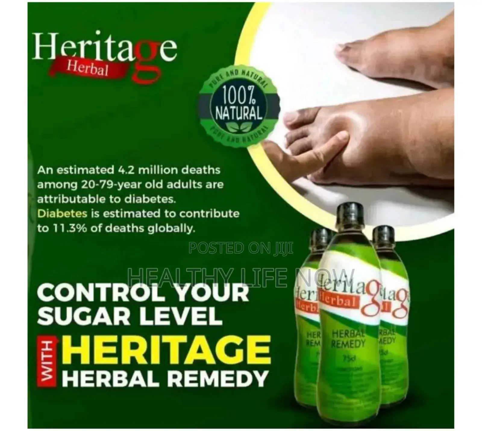 Treat Sugar Ailments With Heritage Herbal Remedy