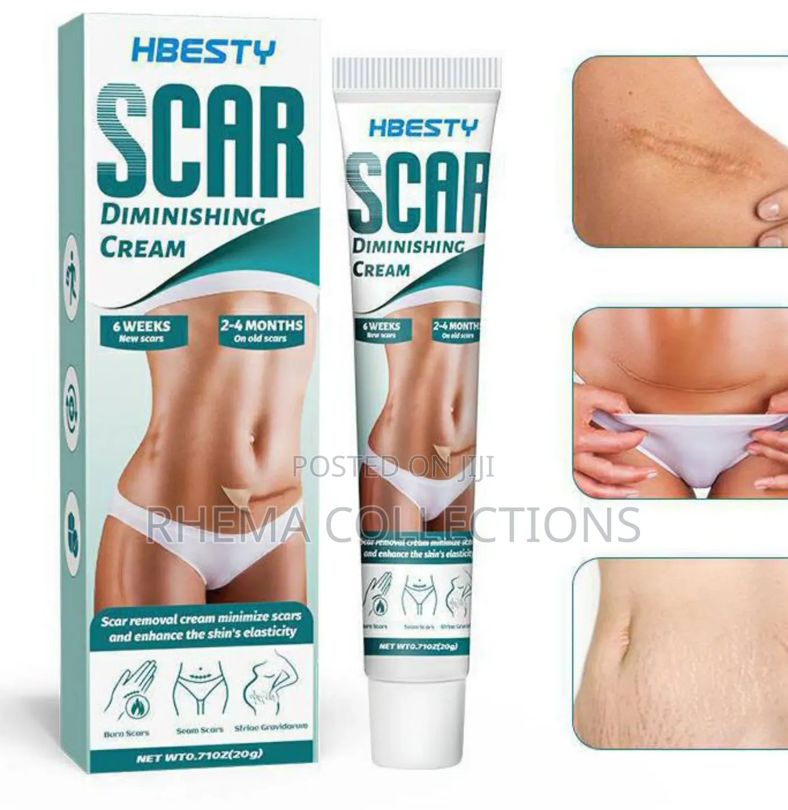 Hbesty Scar Stretch Mark Removal Cream (20g)