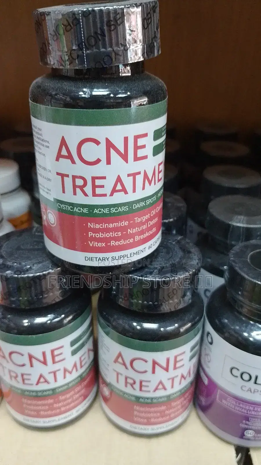 Acne Treatment