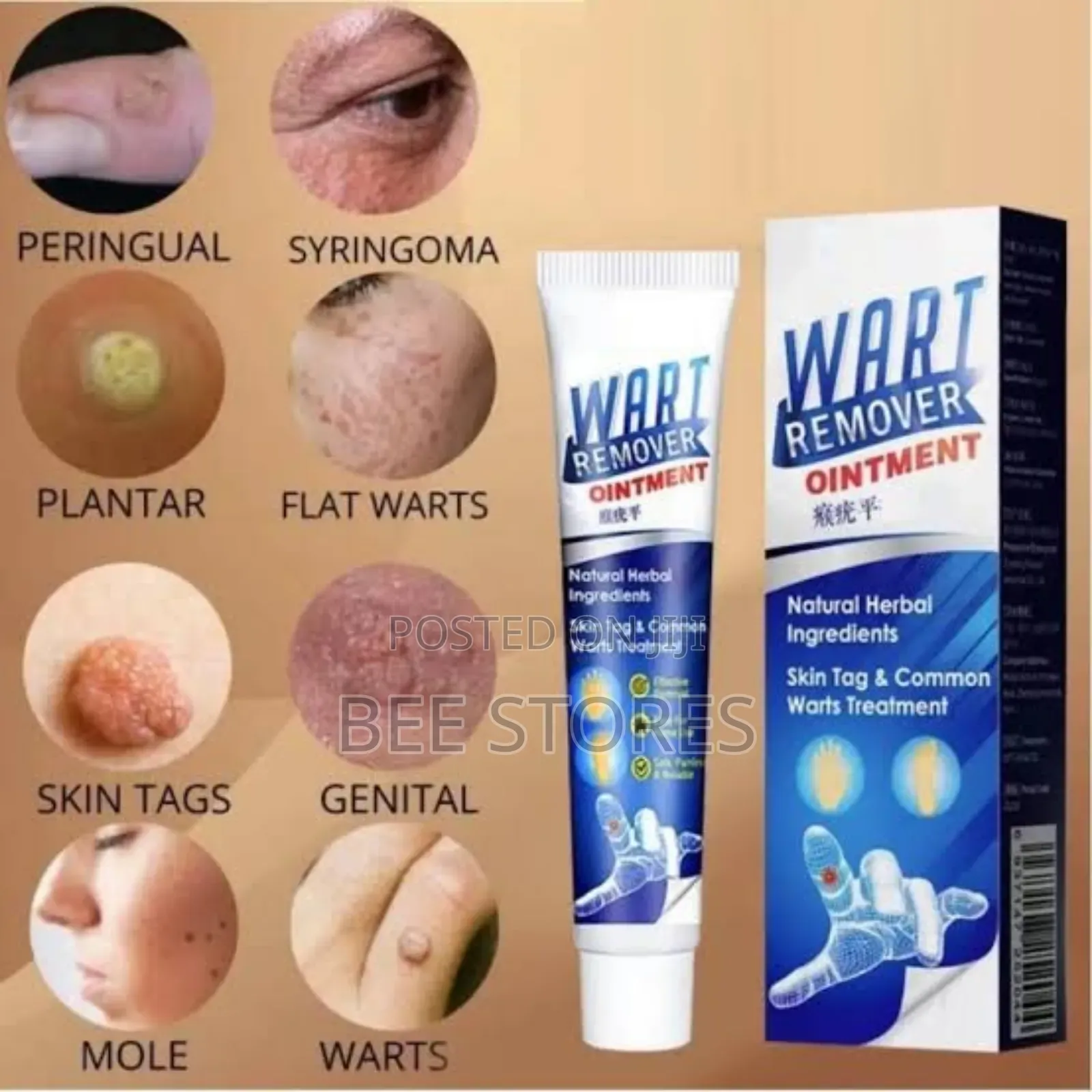 Skin Tag Wart Removal Ointment