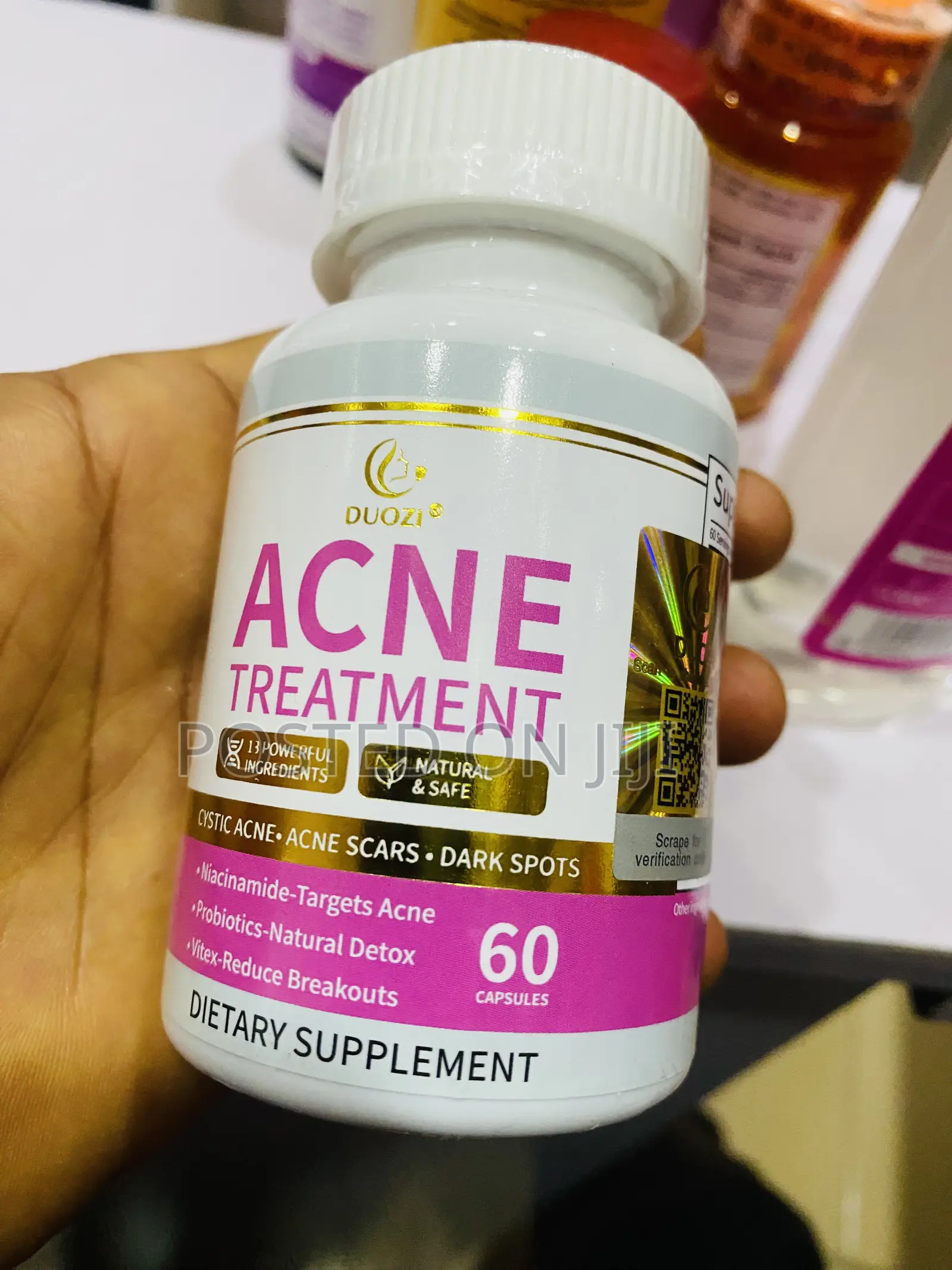 Douzi Acne Treatment for Stubborn Acne