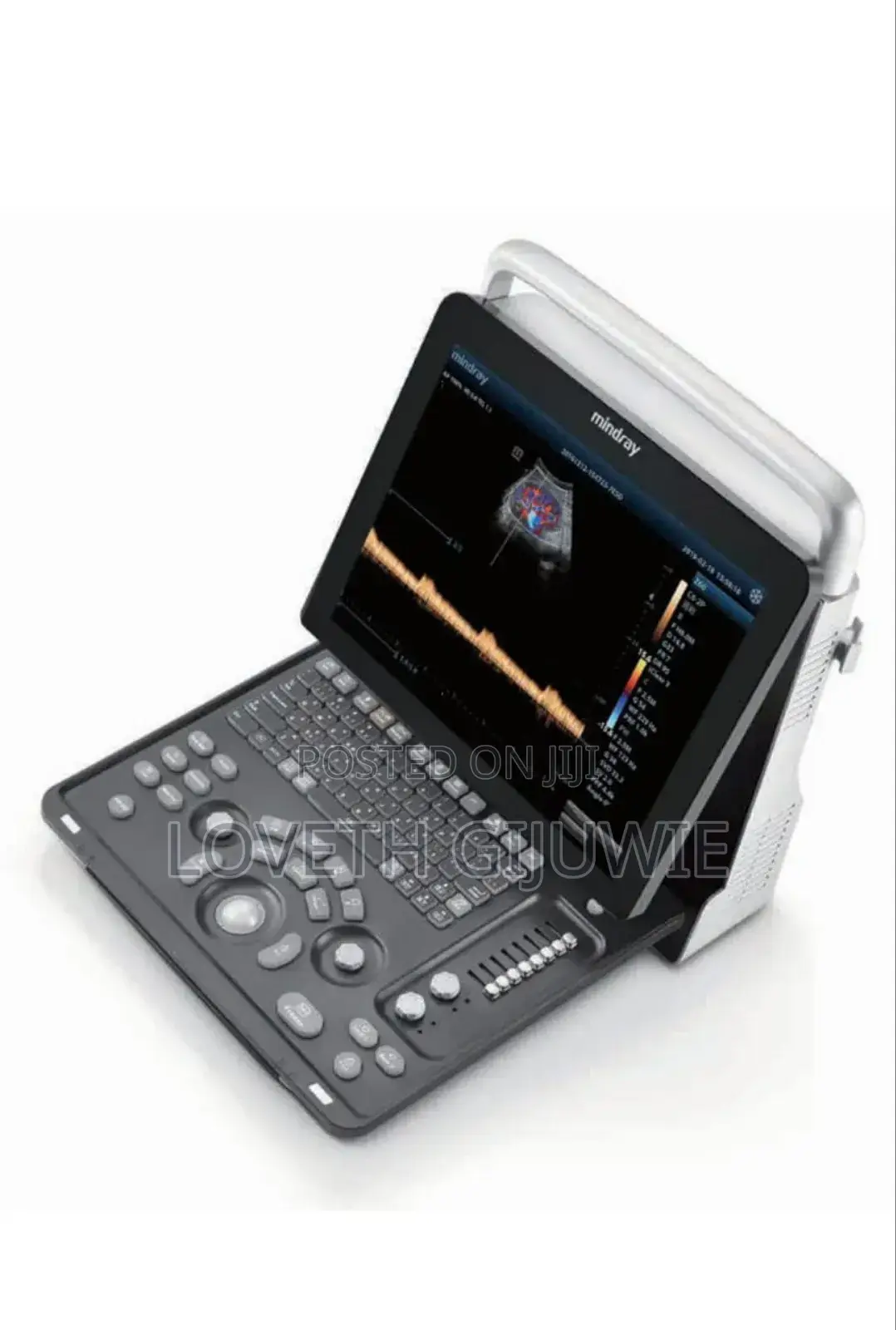 Mindray Z60 Ultrasound Machine