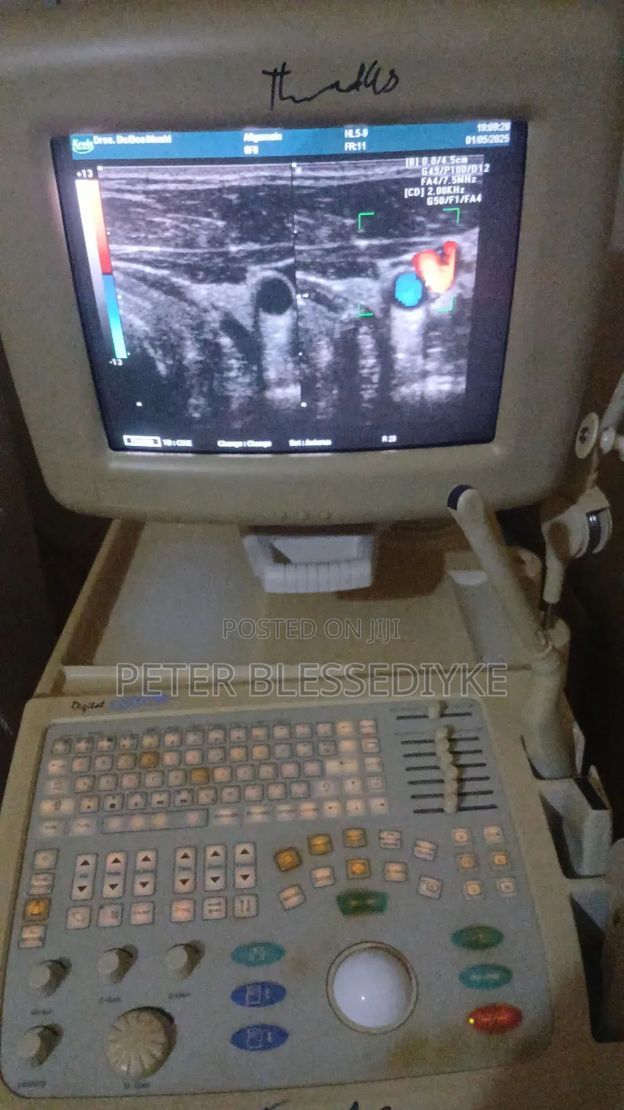 Sonoace 6000 C (2d Color Doppler)
