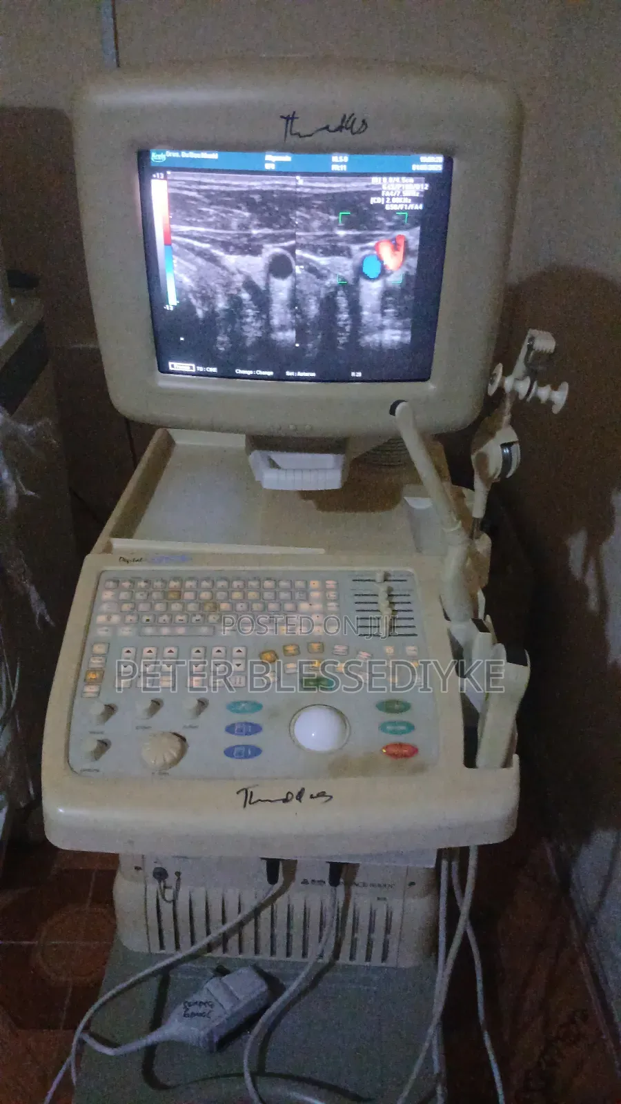 Sonoace 6000 C (2d Color Doppler)