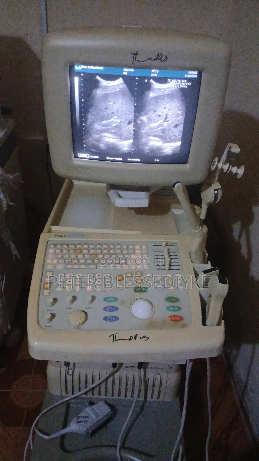 Sonoace 6000 C (2d Color Doppler)