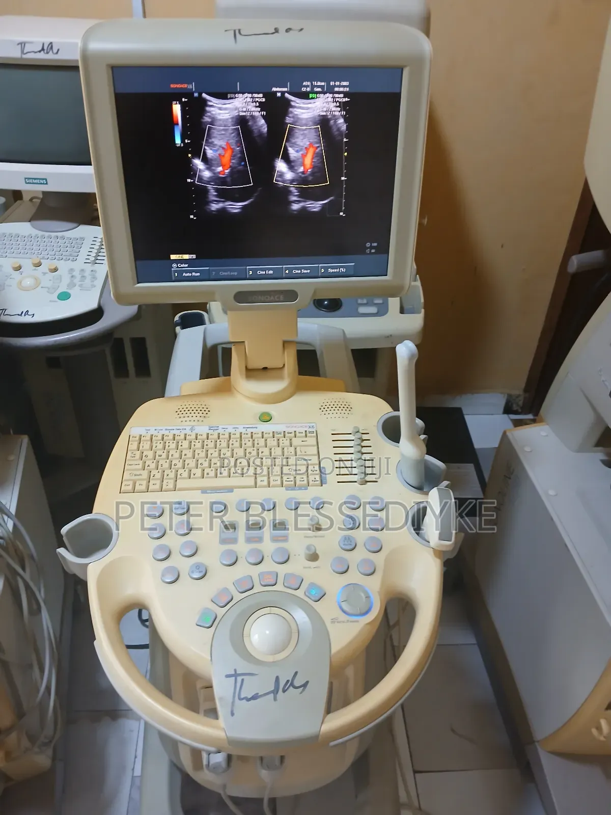 Sonoace X6 2d Colour Doppler