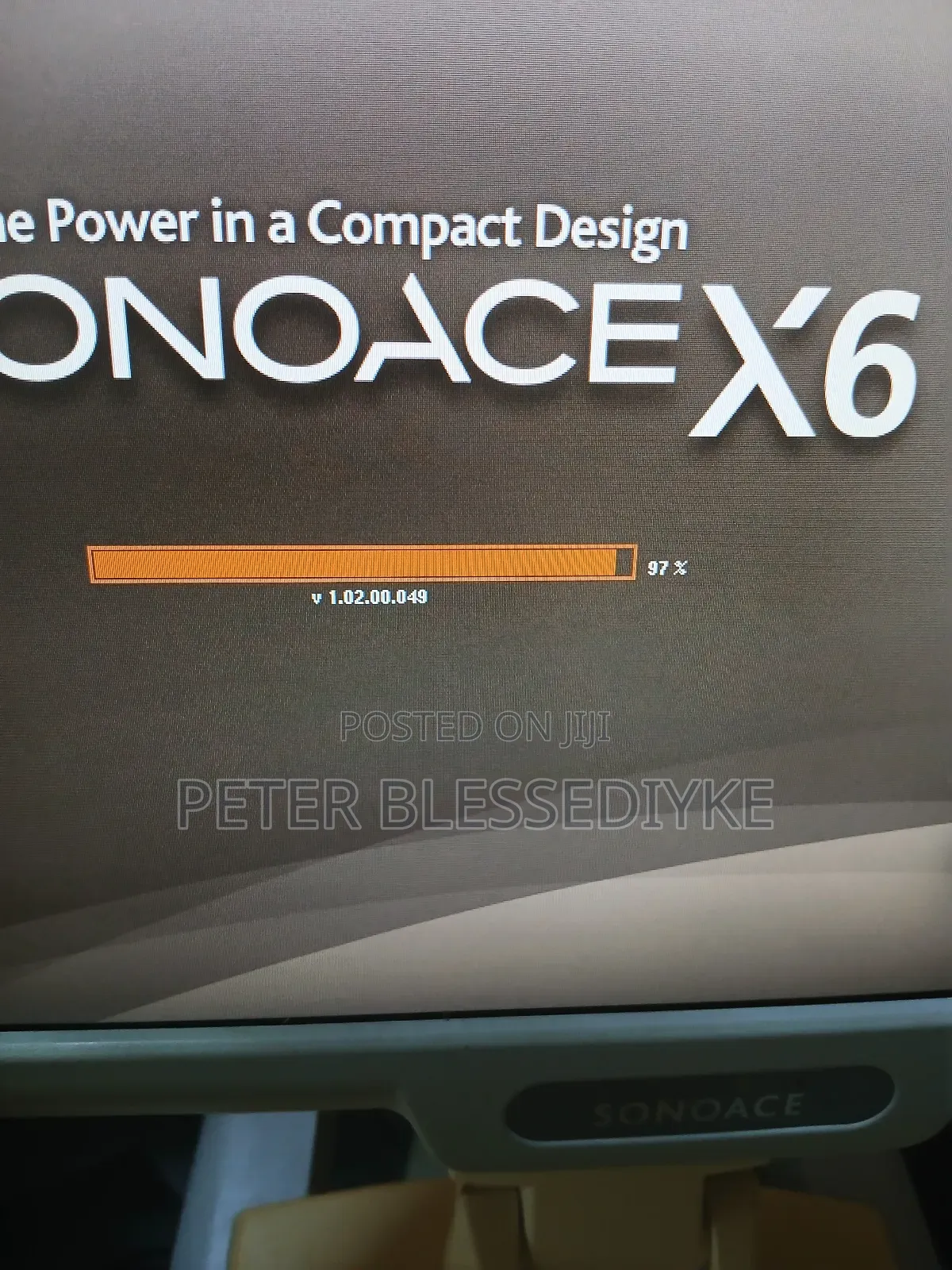 Sonoace X6 2d Colour Doppler