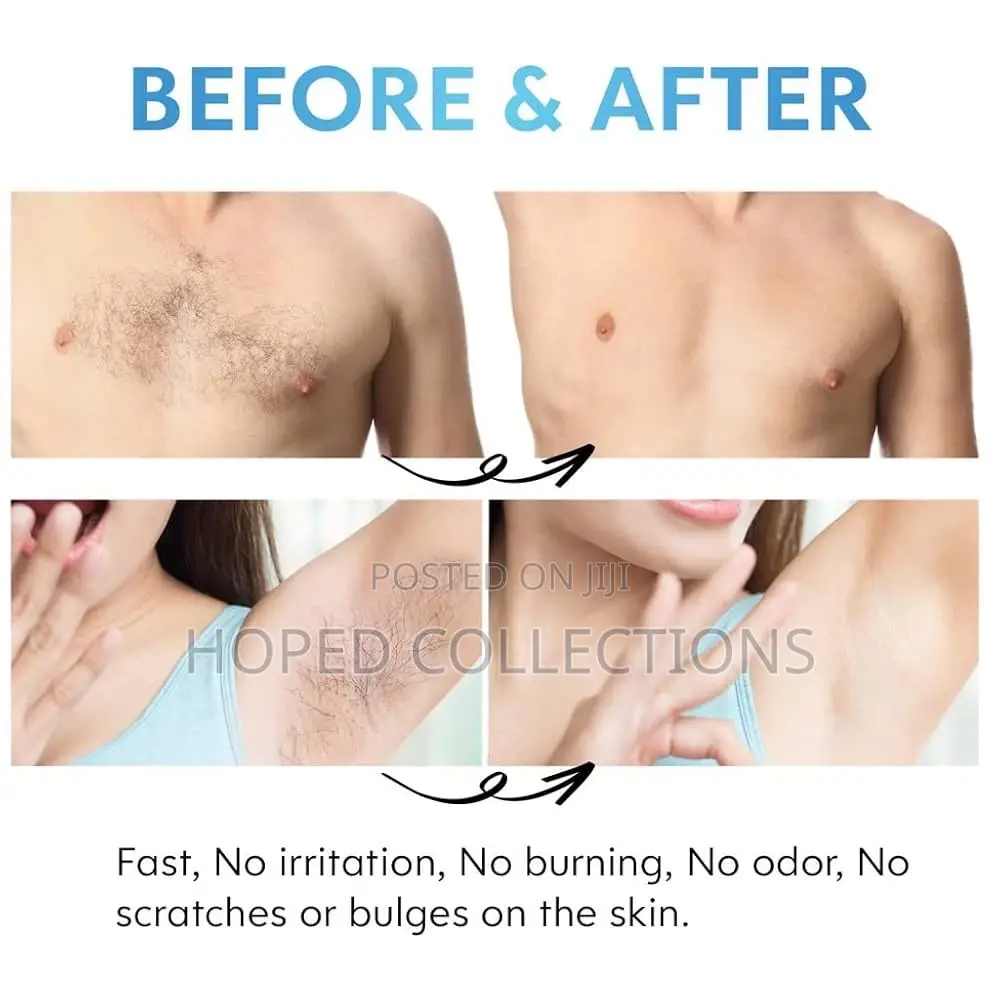 Crystal Hair Removal