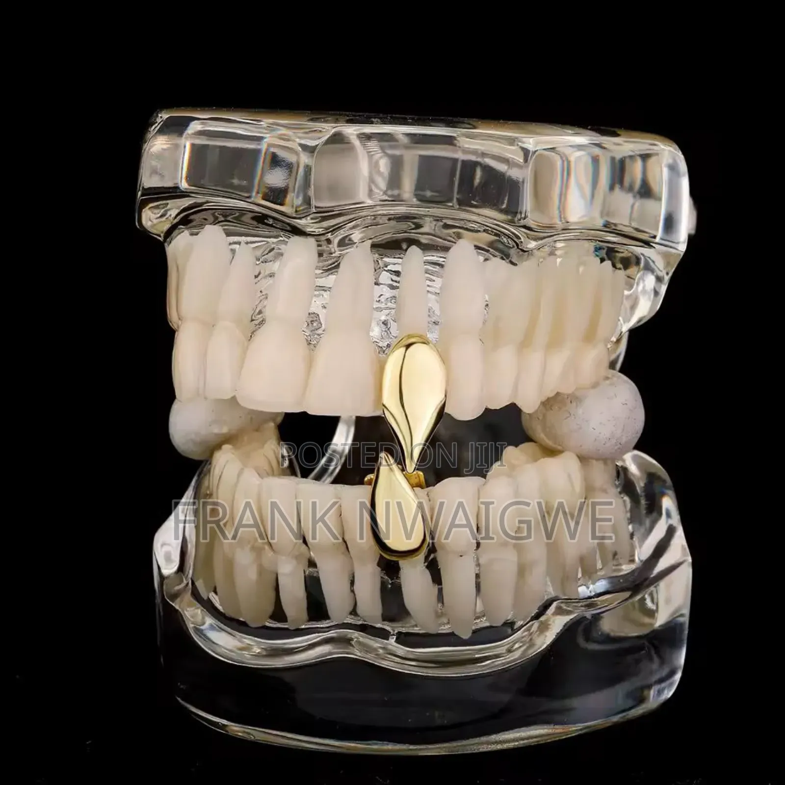 Vampire Fangs Gold and Silver Single Tooth Grills