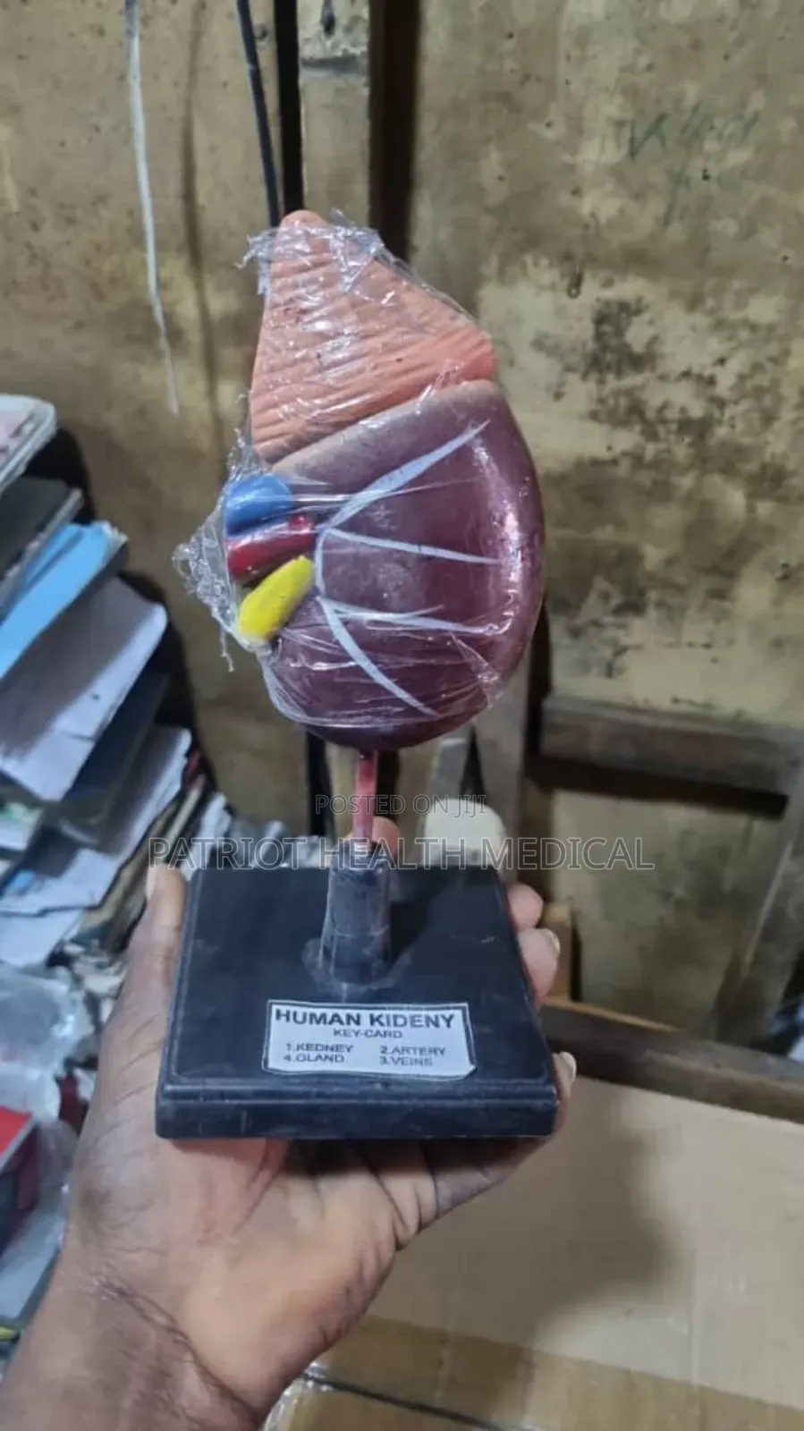 Human Kidney Model