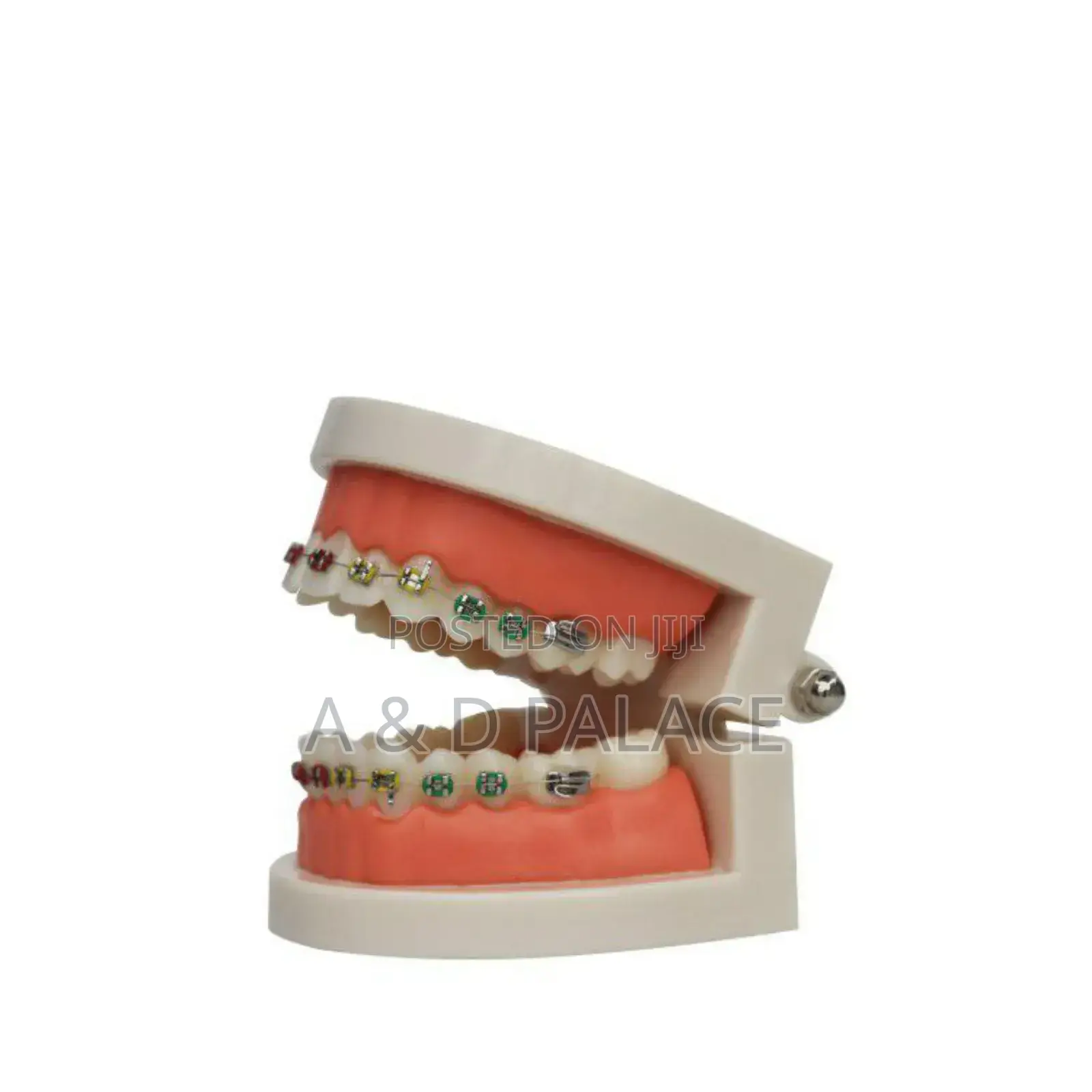 Teeth Brace