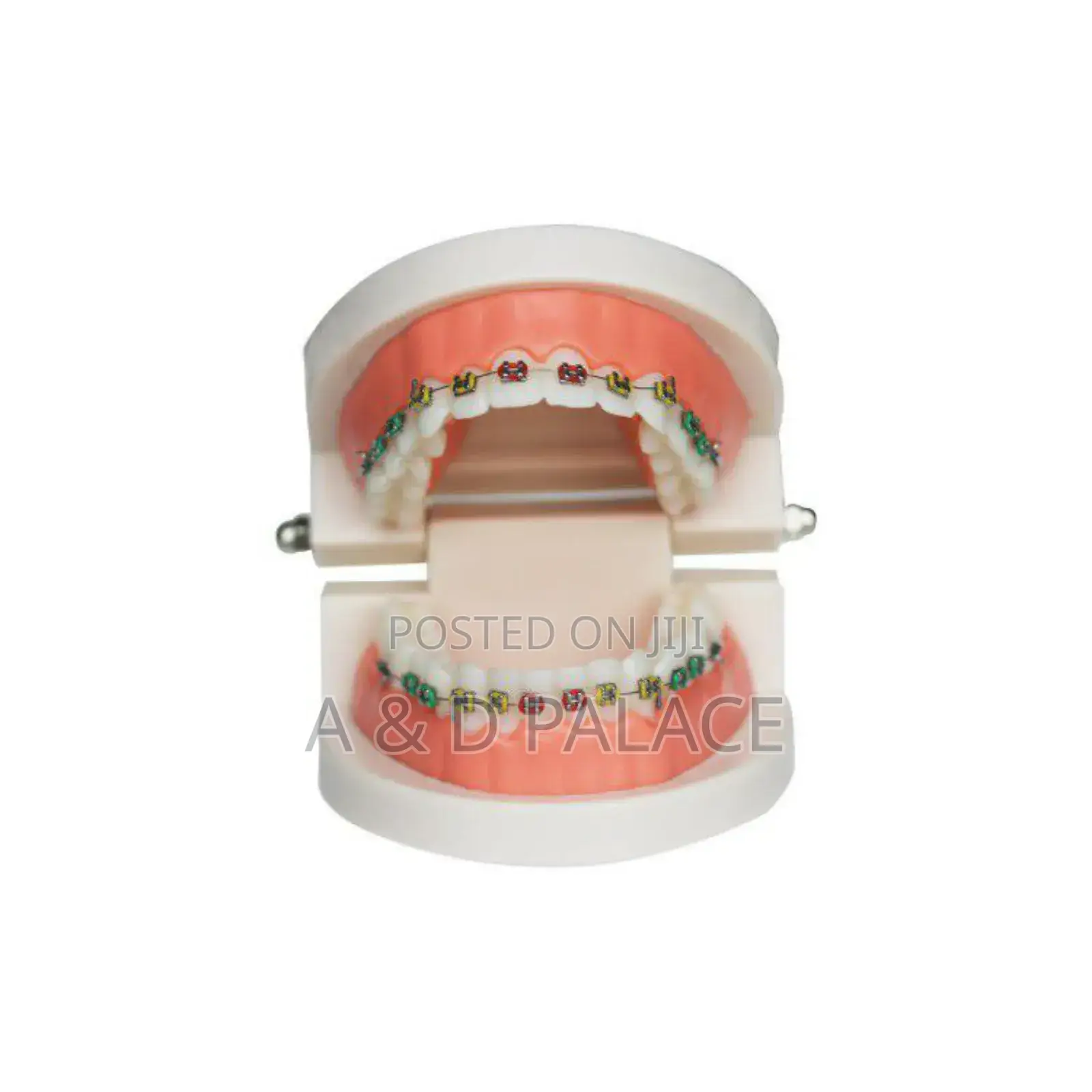 Teeth Brace