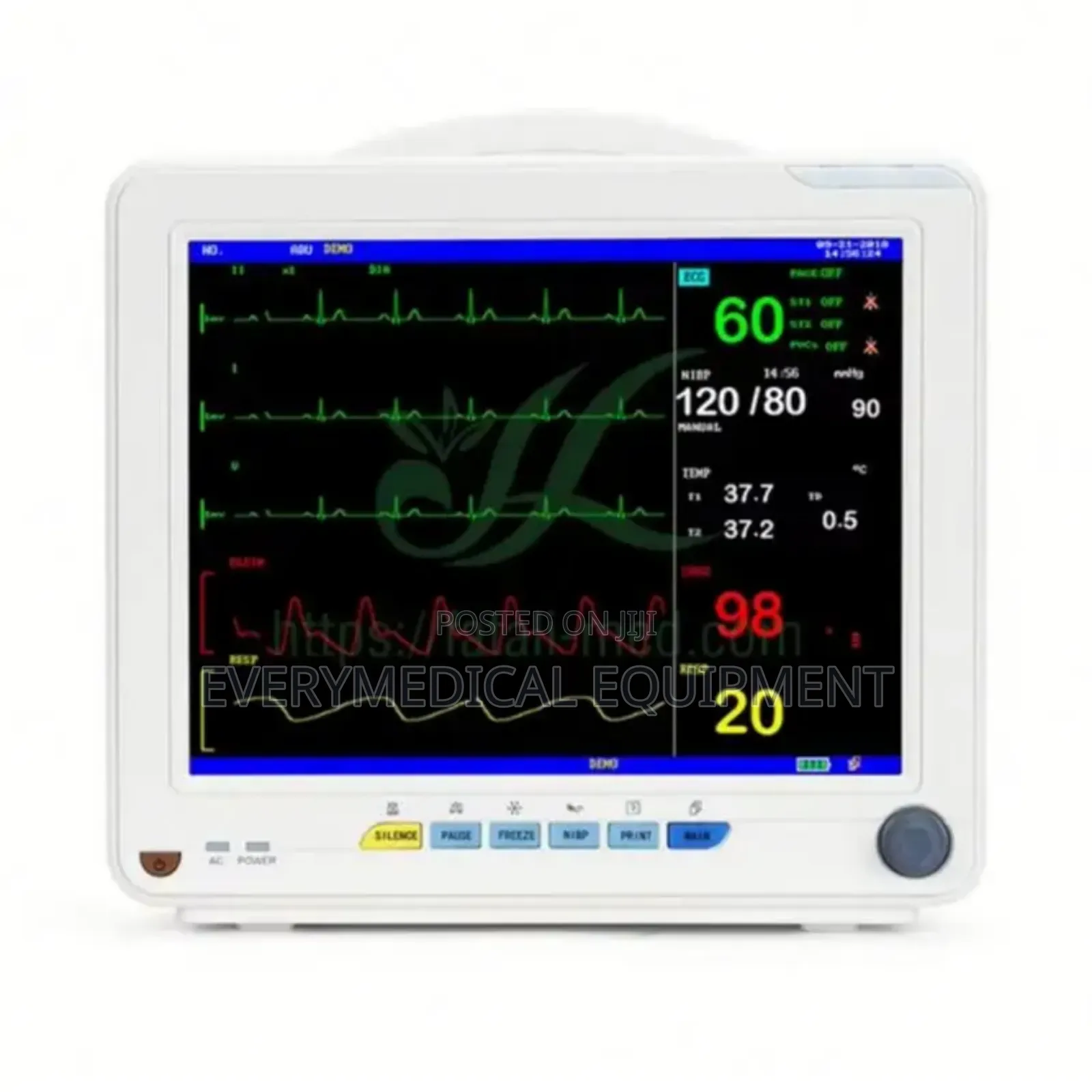 Patient Monitor