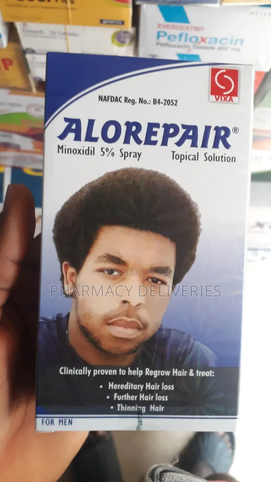 Alorepair Minoxidil 5% Spray – Hair Regrowth Treatment