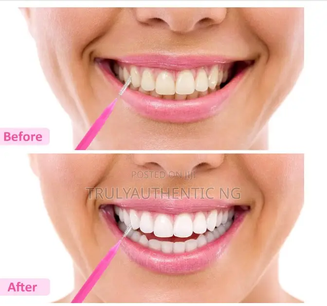 Premium Interdental Brush for Dental Braces – Tooth Flossing- 100 PCS