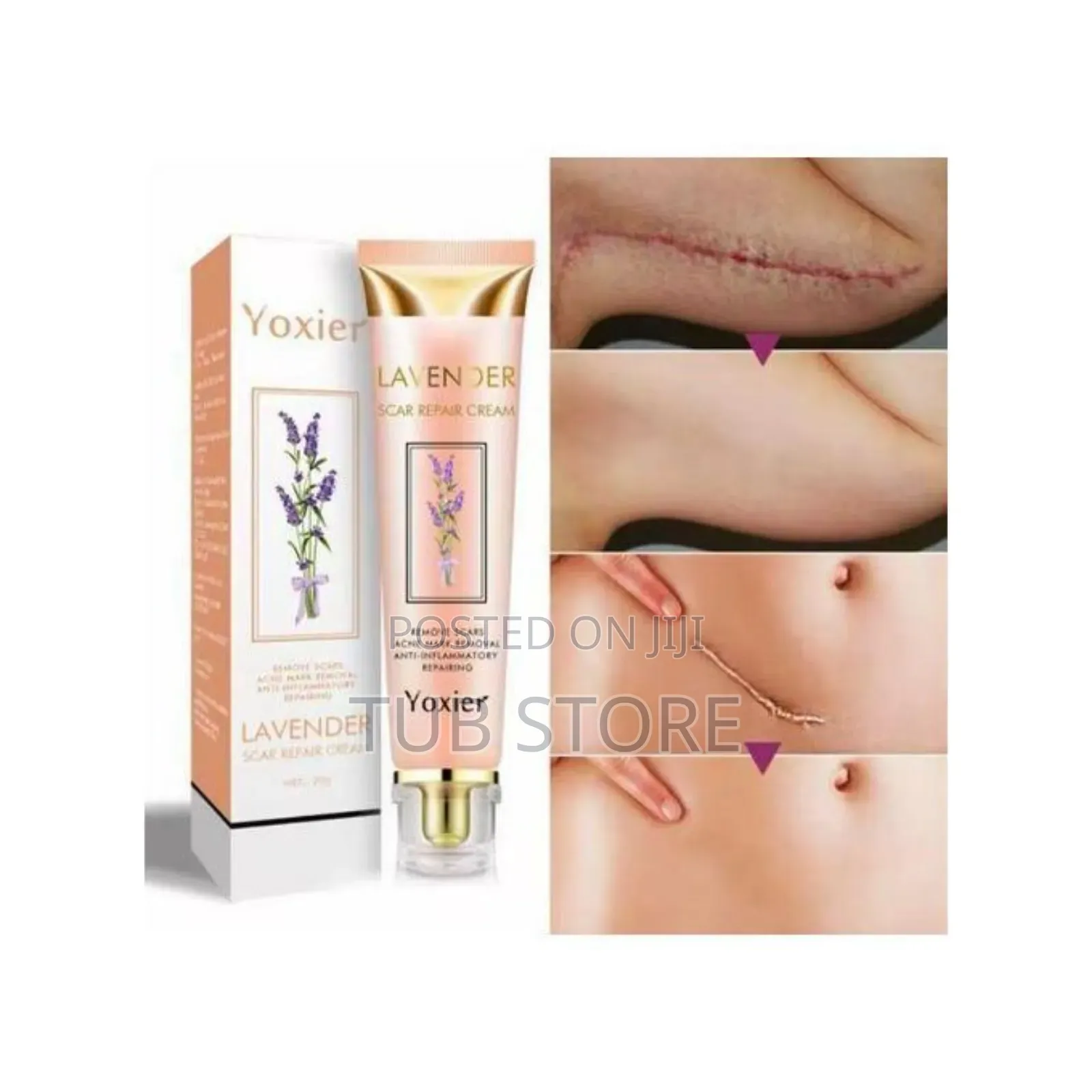 Yoxier Scar Remover Cream