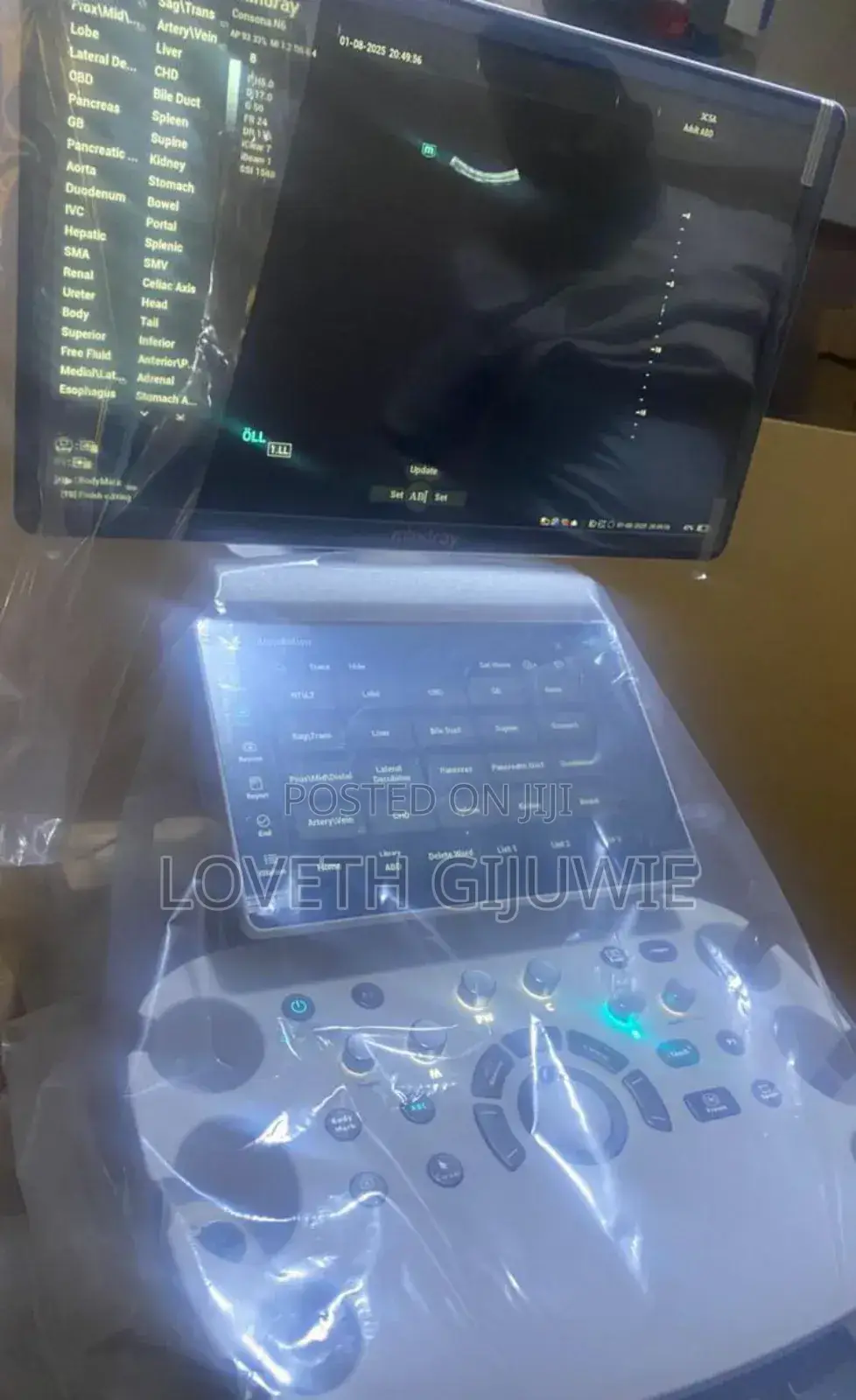 Mindray Consona N6 Ultrasound Machine