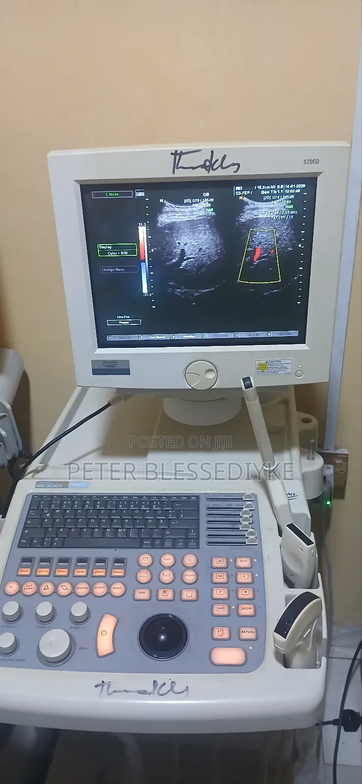 Sonoace 8000 Ex