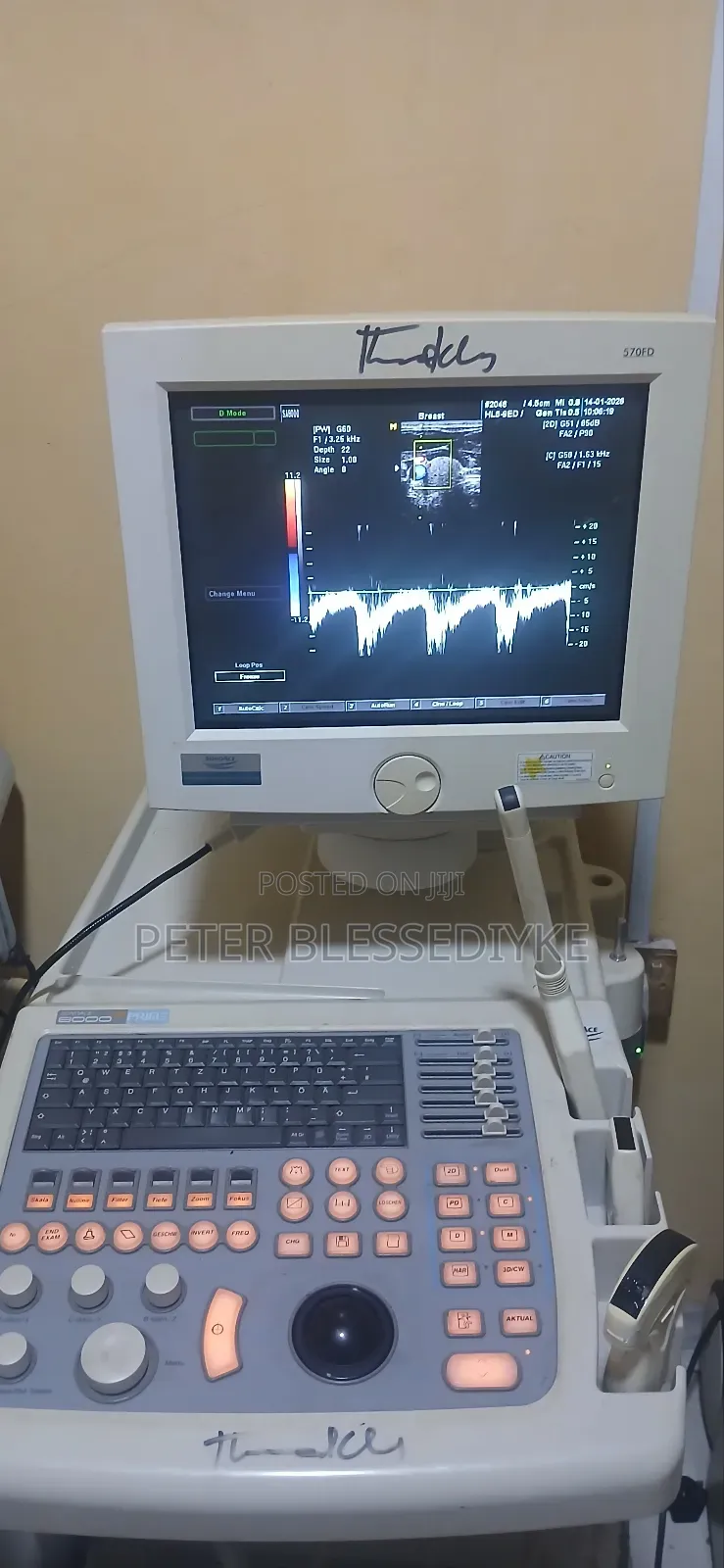 Sonoace 8000 Ex