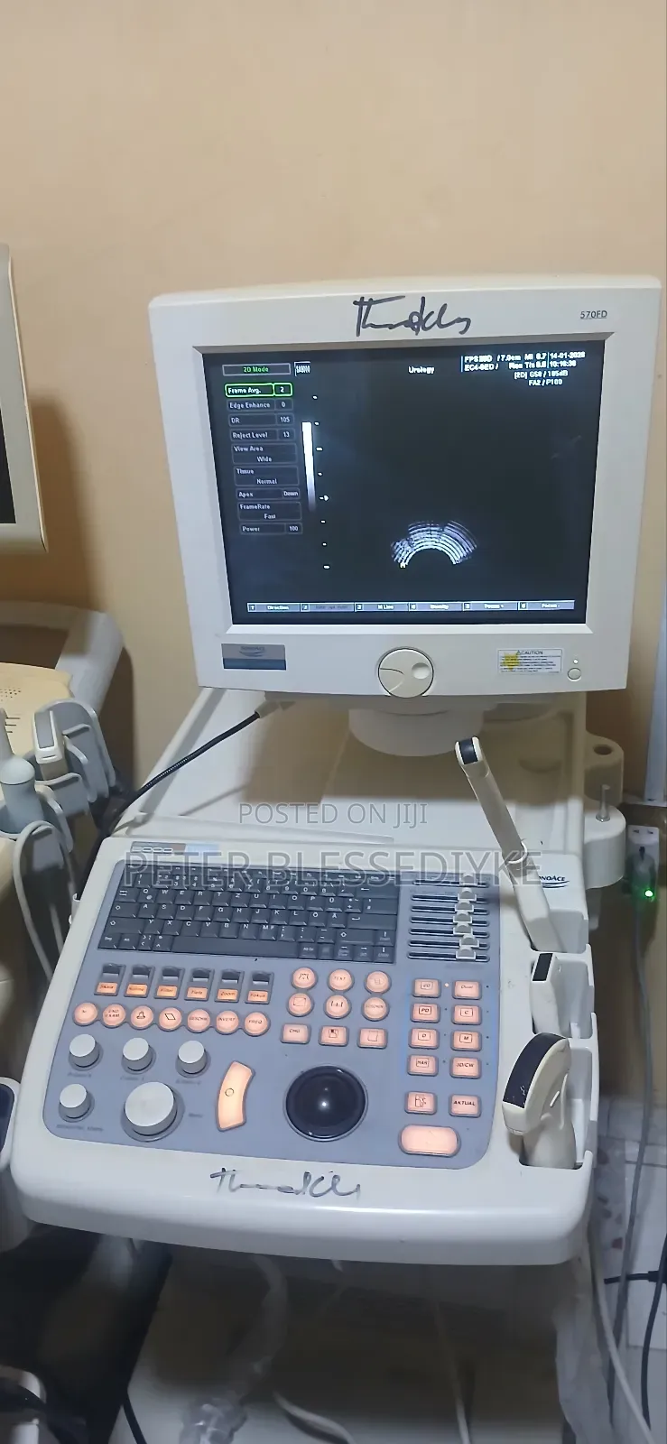 Sonoace 8000 Ex