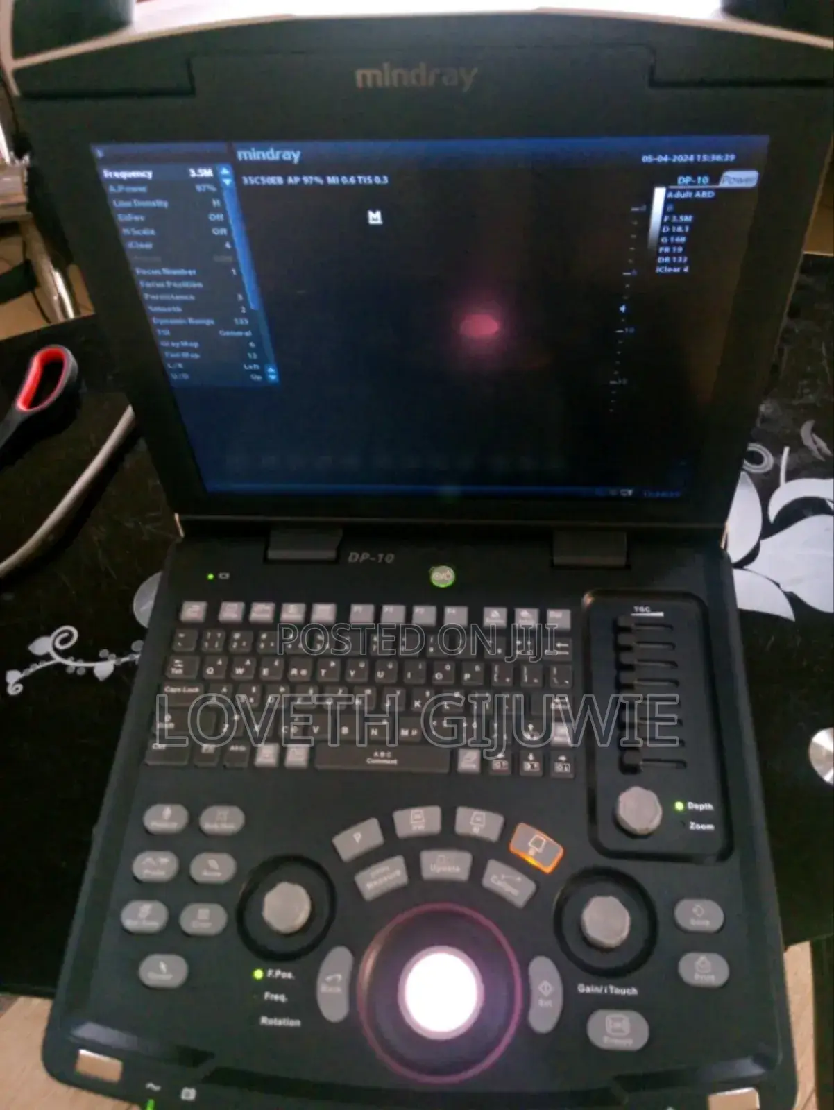 Mindray Dp 10 Ultrasound Machine