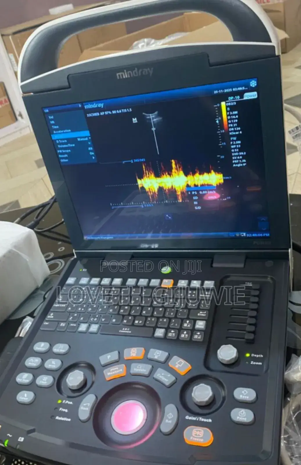 Mindray Dp 10 Ultrasound Machine