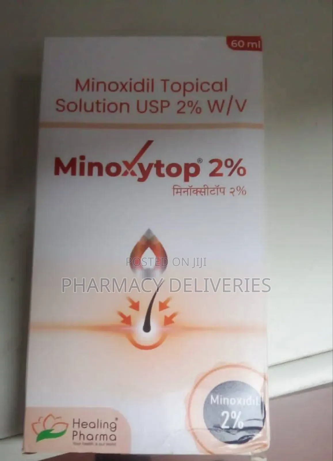 Minoxytop 2% Minoxidil Solution - Hair Regrowth Anti-Hair Loss