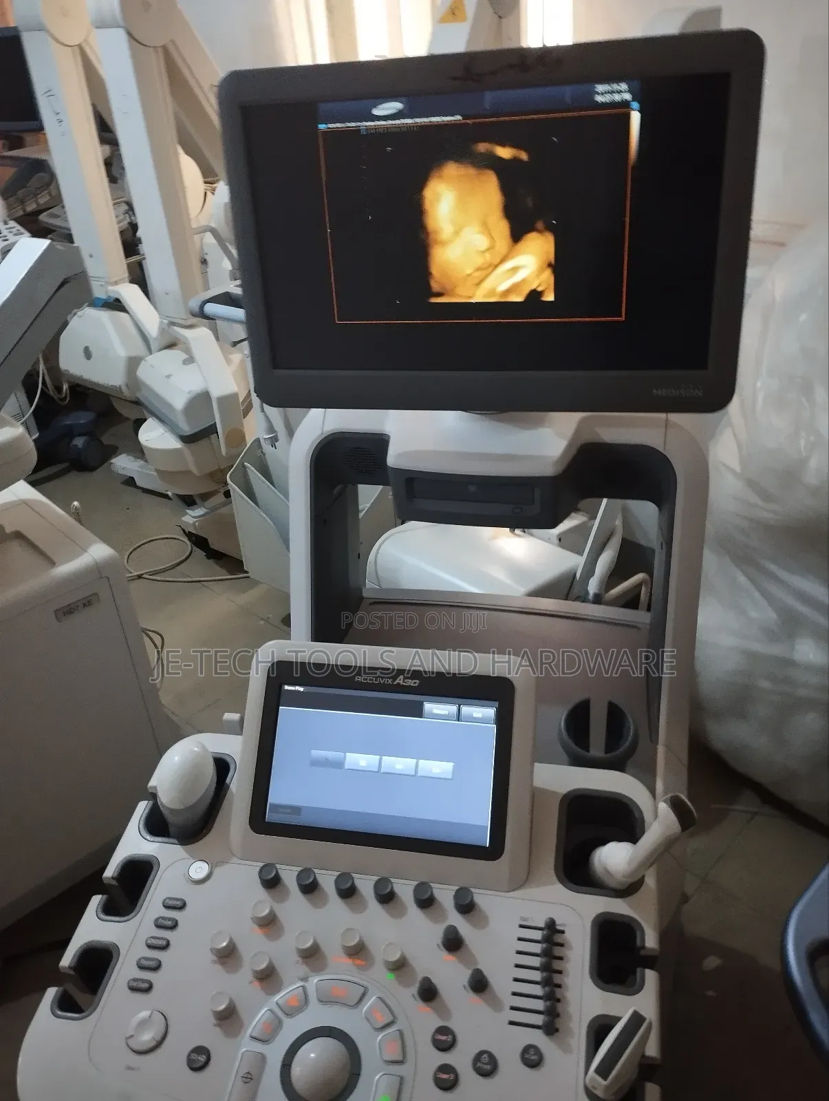 Sonoace Accuvix A30 Ultrasound Machine (3d/ 4d)
