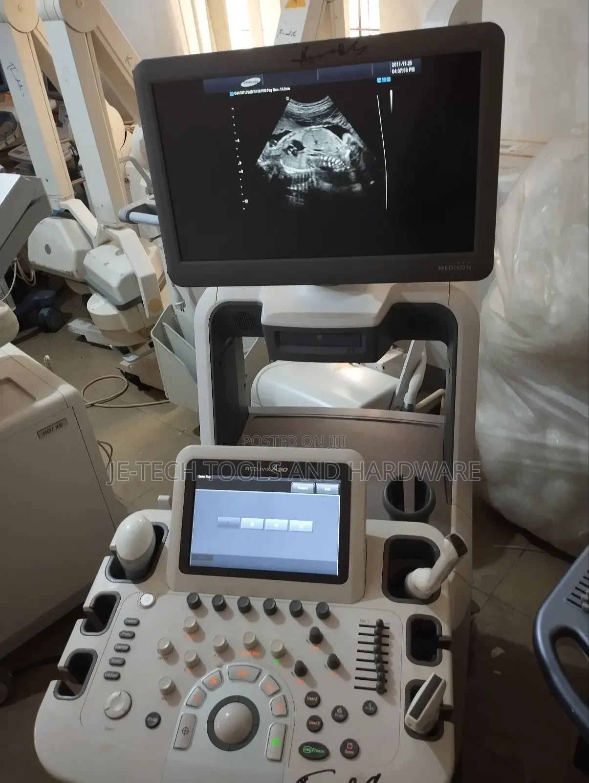 Sonoace Accuvix A30 Ultrasound Machine (3d/ 4d)