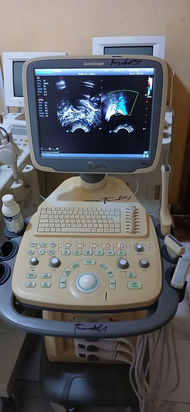 Sonoscape S11