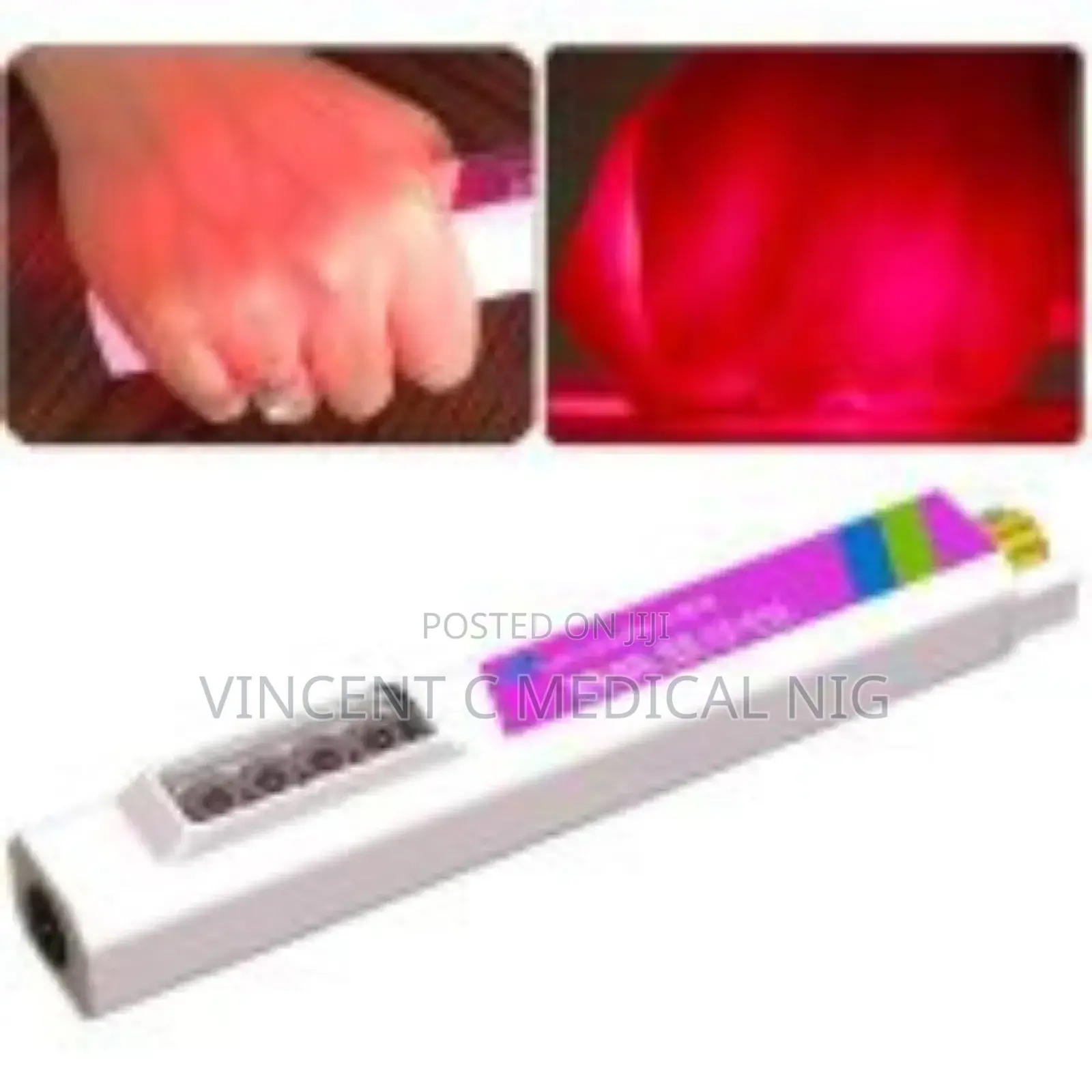 Vein Finder