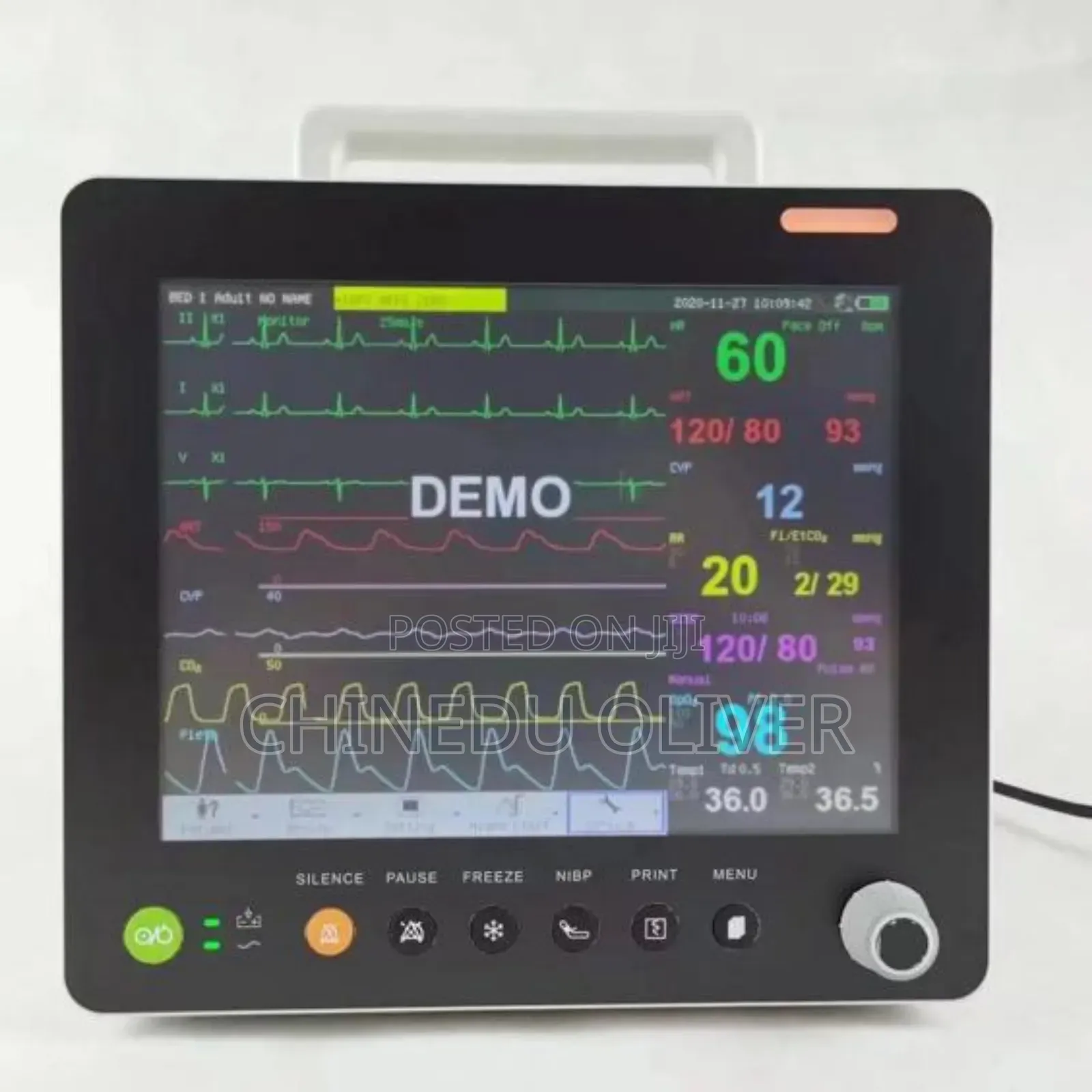 Patient Monitor