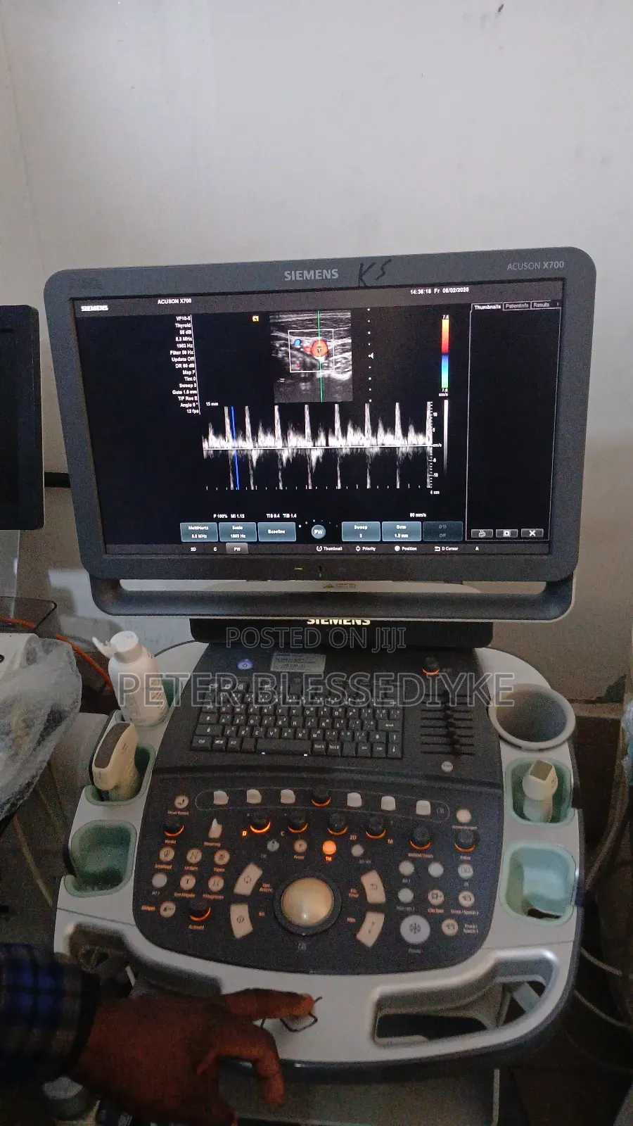 Siemens Acuson X700
