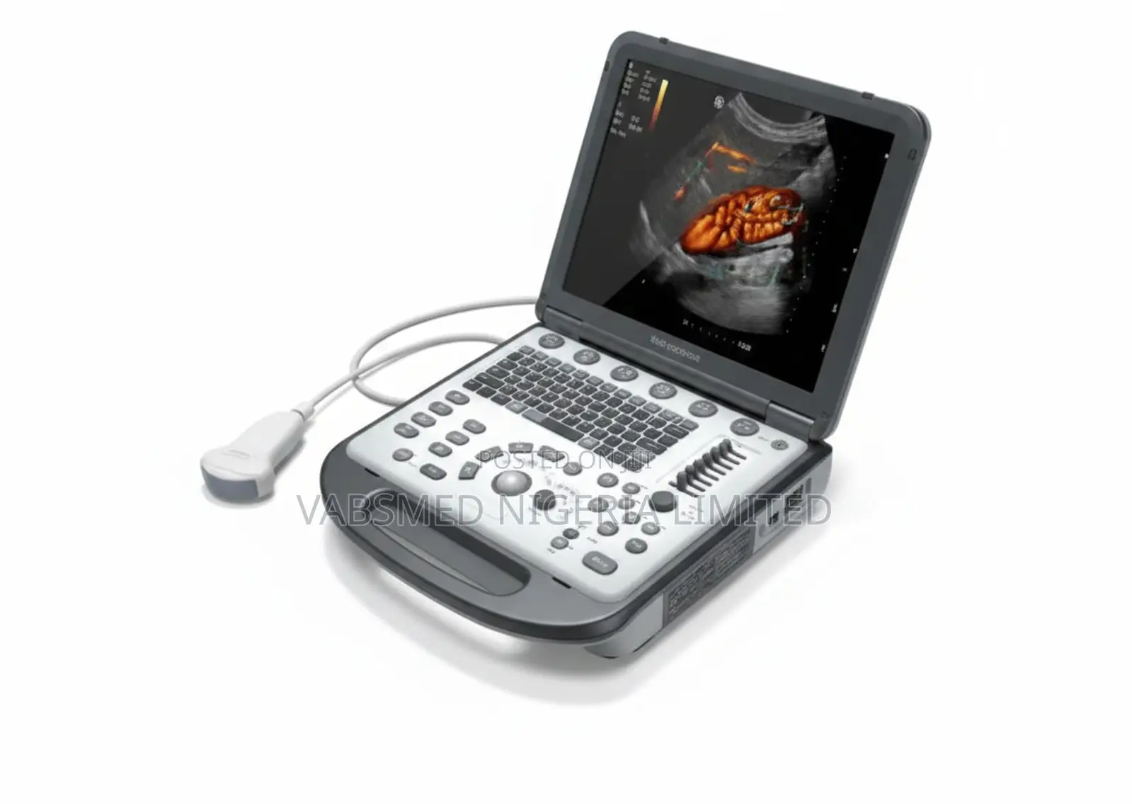 Portable Digital Ultrasound System - Dp 10